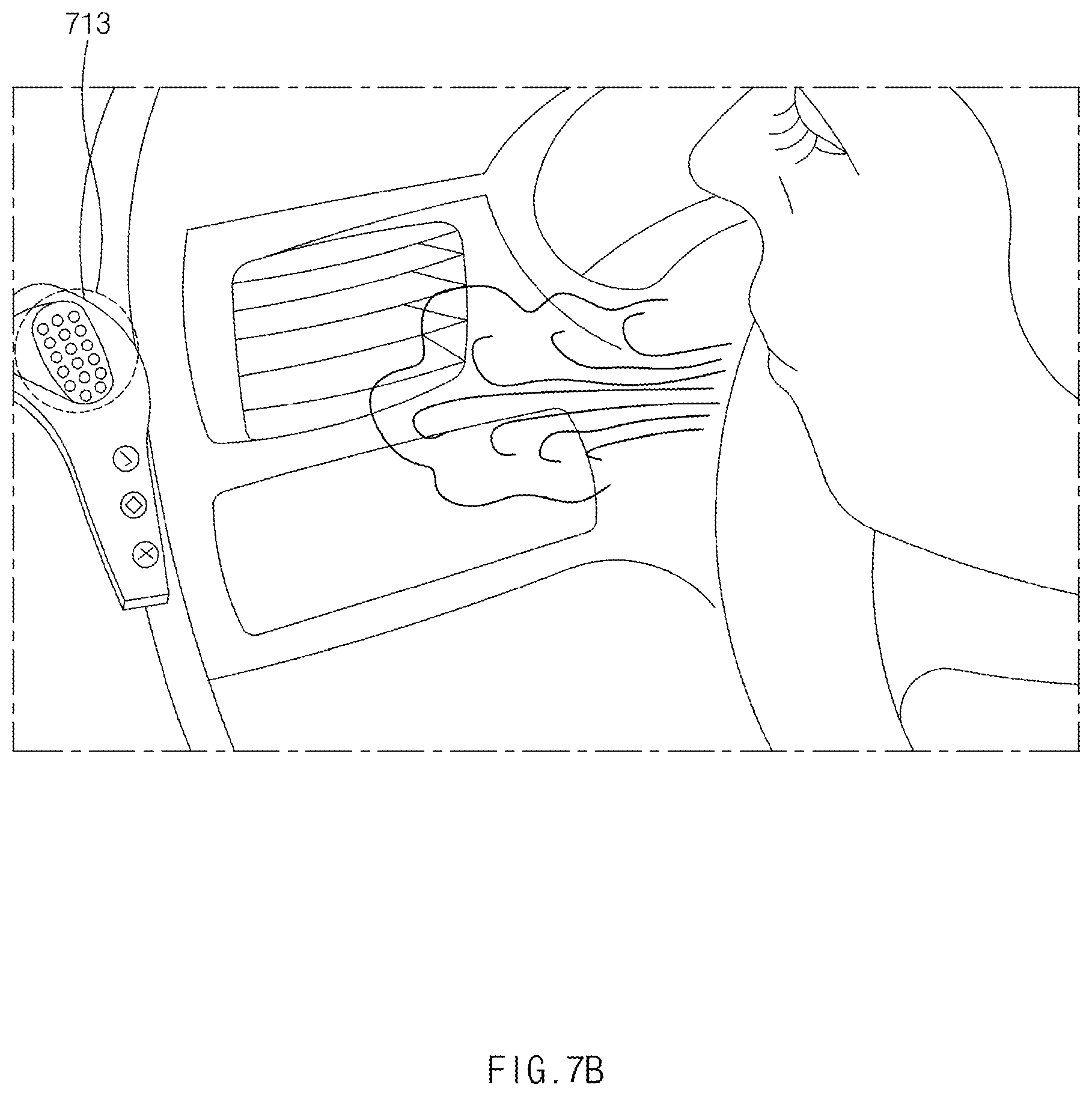 Patent US12617409 Figure 11 – Drunk driving prevention system and method