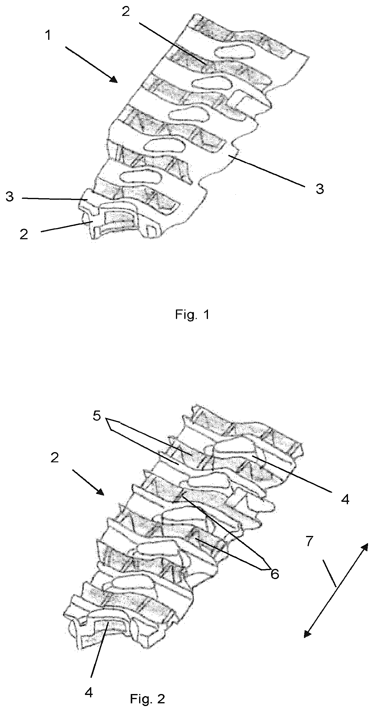 Patent US12617476 Figure 1 – Reinforcement of a vehicle structure where a gear box is connected
