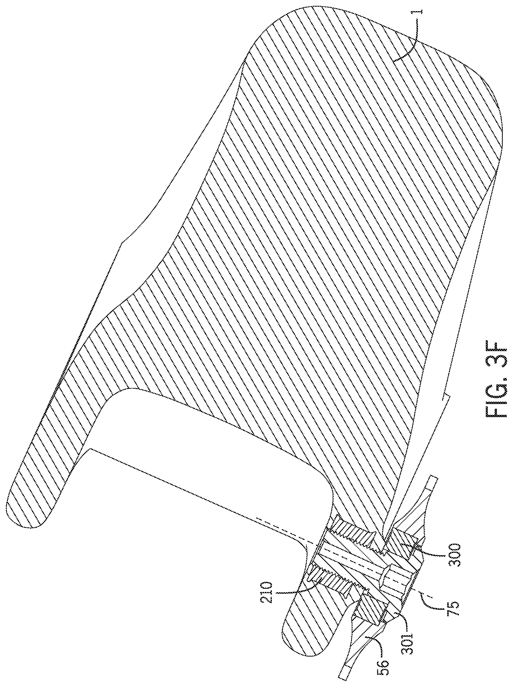 Patent US12617488 Figure 19 – Two-wheeled vehicle with configurable idler