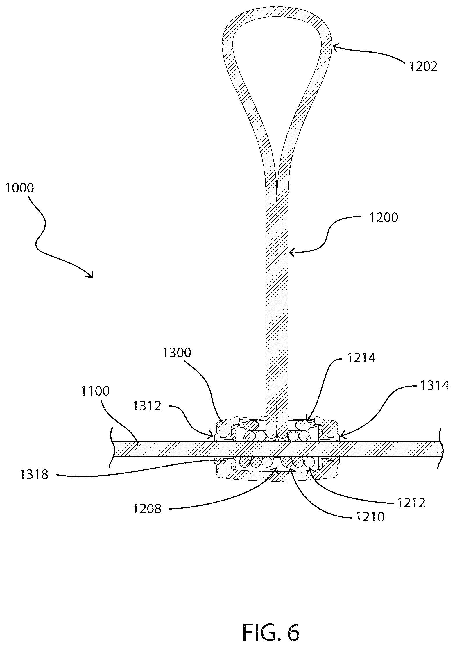Patent US12617494 Figure 13 – Adjustable tether line systems and securement methods