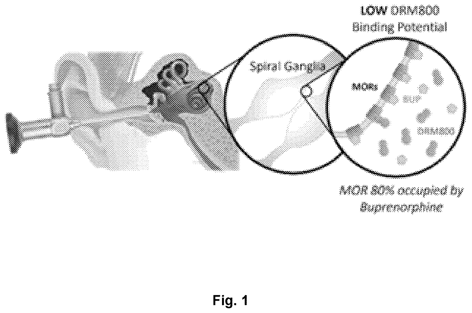 Patent US12617816 — Composition and method for in vivo assay of opioid receptors — Figure 1