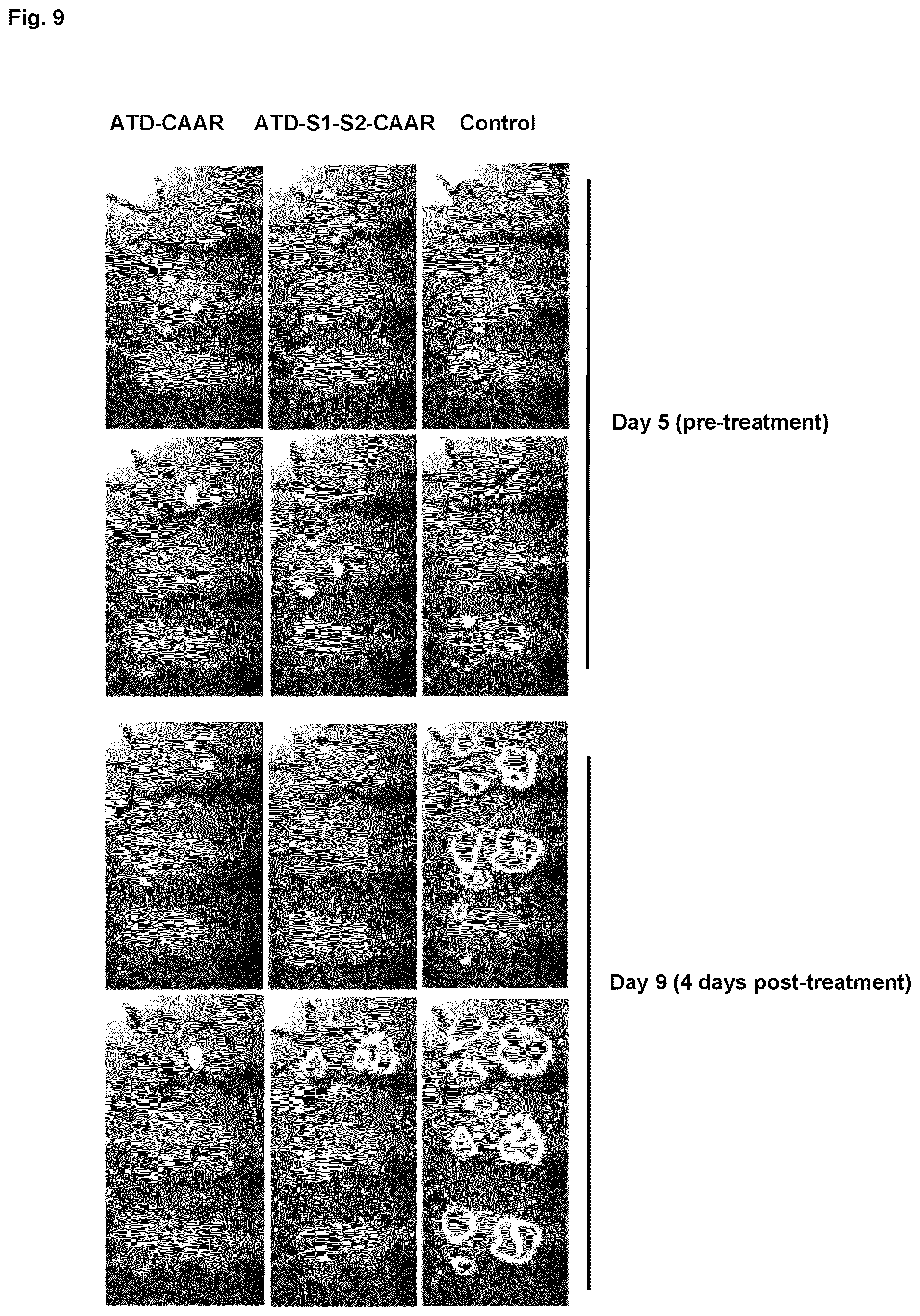 Patent US12617835 Figure 7 – Chimeric autoantibody receptor (CAAR) that binds autoantibodies targeting the central nervous system in neurological autoimmune disease