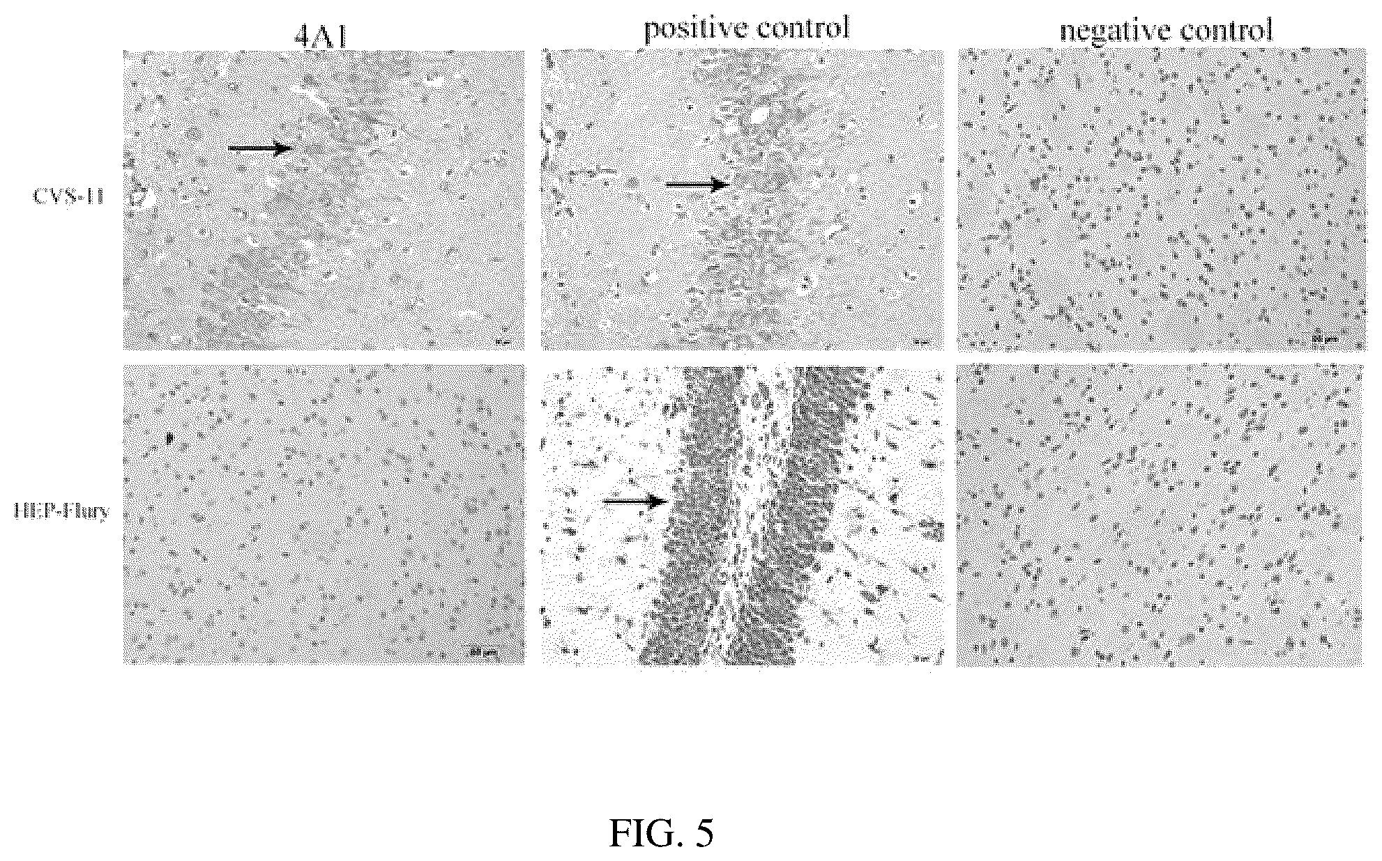 Patent US12617840 Figure 3 – Hybridoma cell line for secreting anti-rabies virus M protein monoclonal antibody and application thereof
