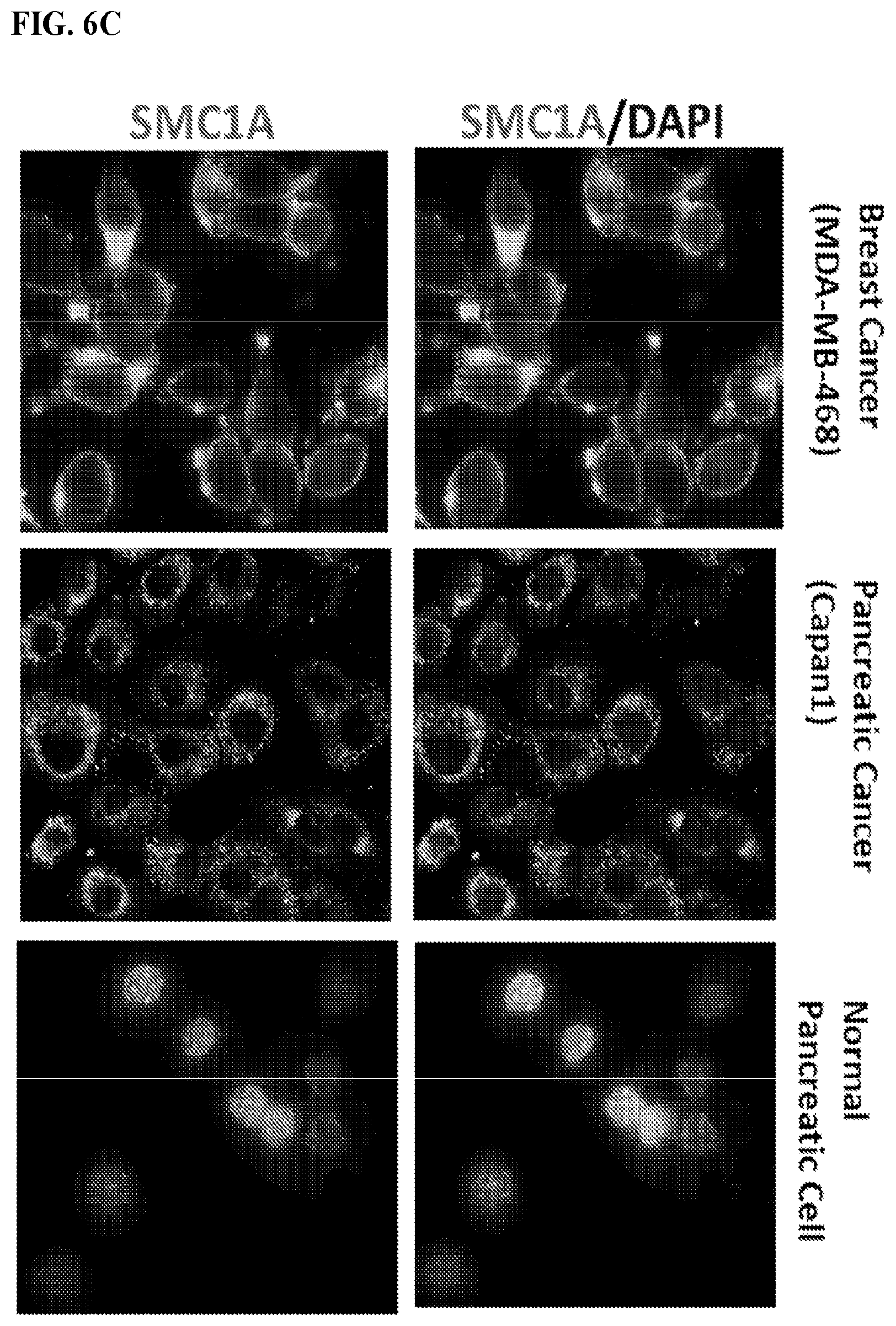 Patent US12617845 Figure 10 – SMC1A antibodies and uses thereof