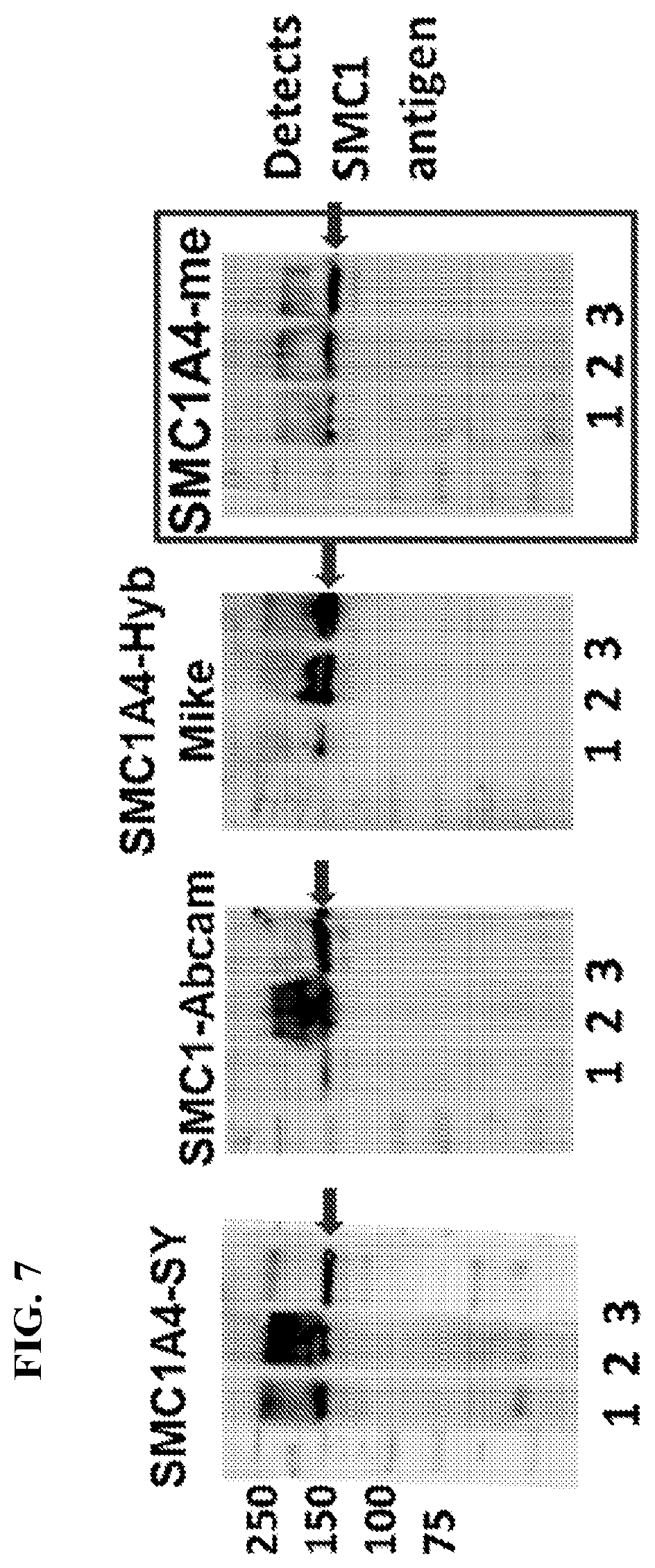 Patent US12617845 Figure 11 – SMC1A antibodies and uses thereof
