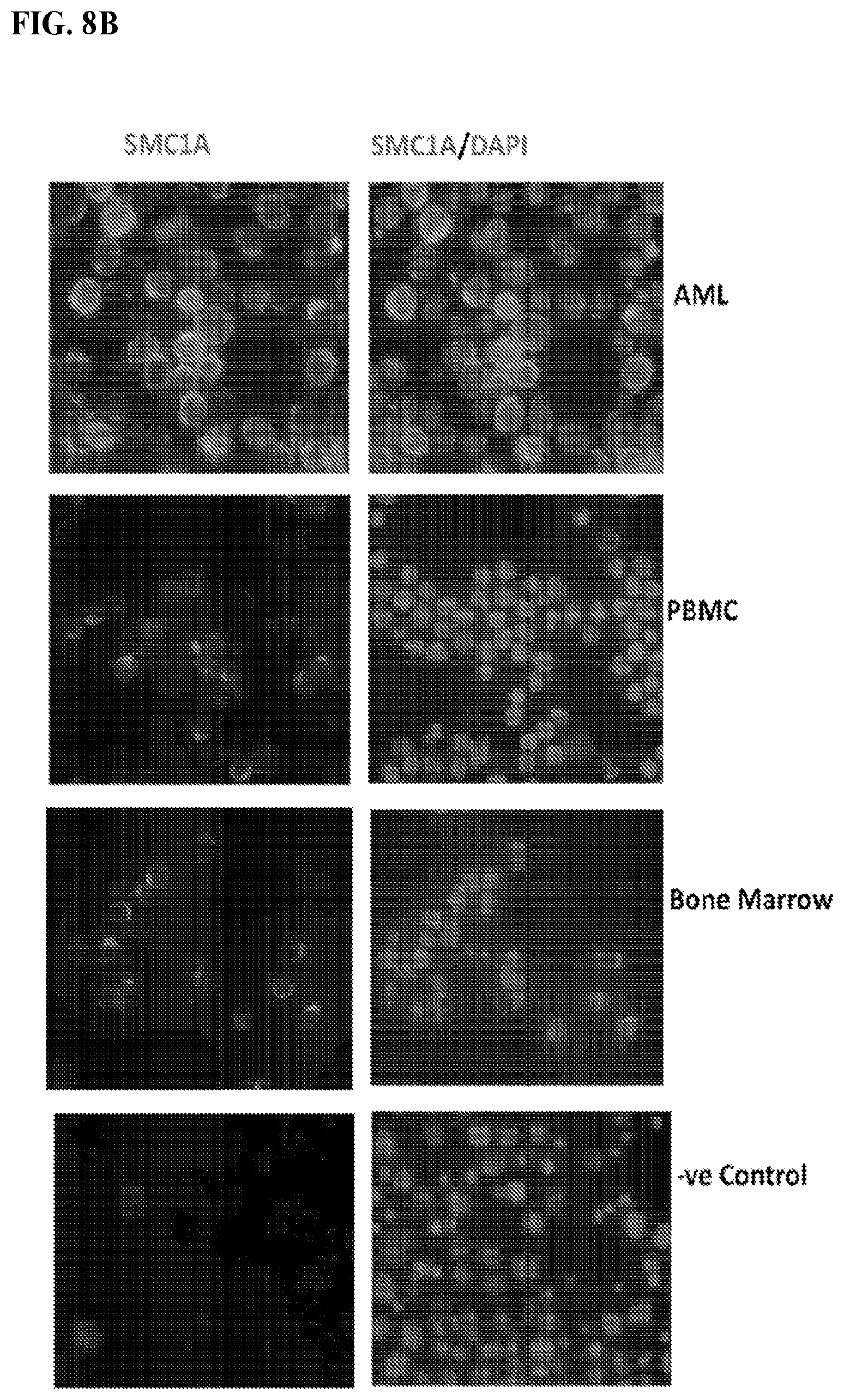 Patent US12617845 Figure 13 – SMC1A antibodies and uses thereof