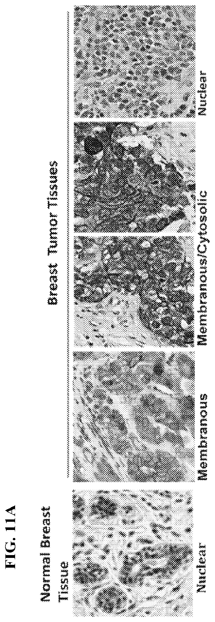Patent US12617845 Figure 17 – SMC1A antibodies and uses thereof