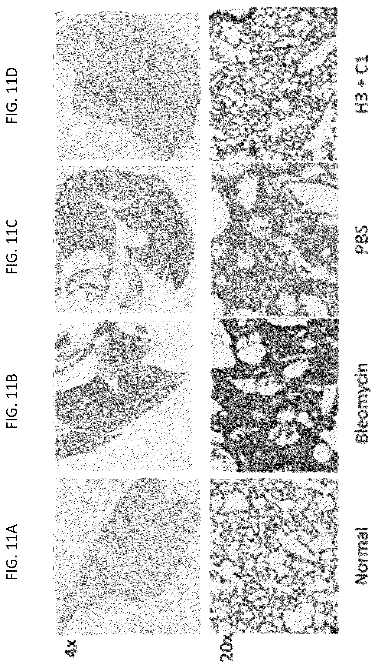 Patent US12617848 Figure 11 – Methods of treating ocular pathologies using bifunctional molecules that target growth factors