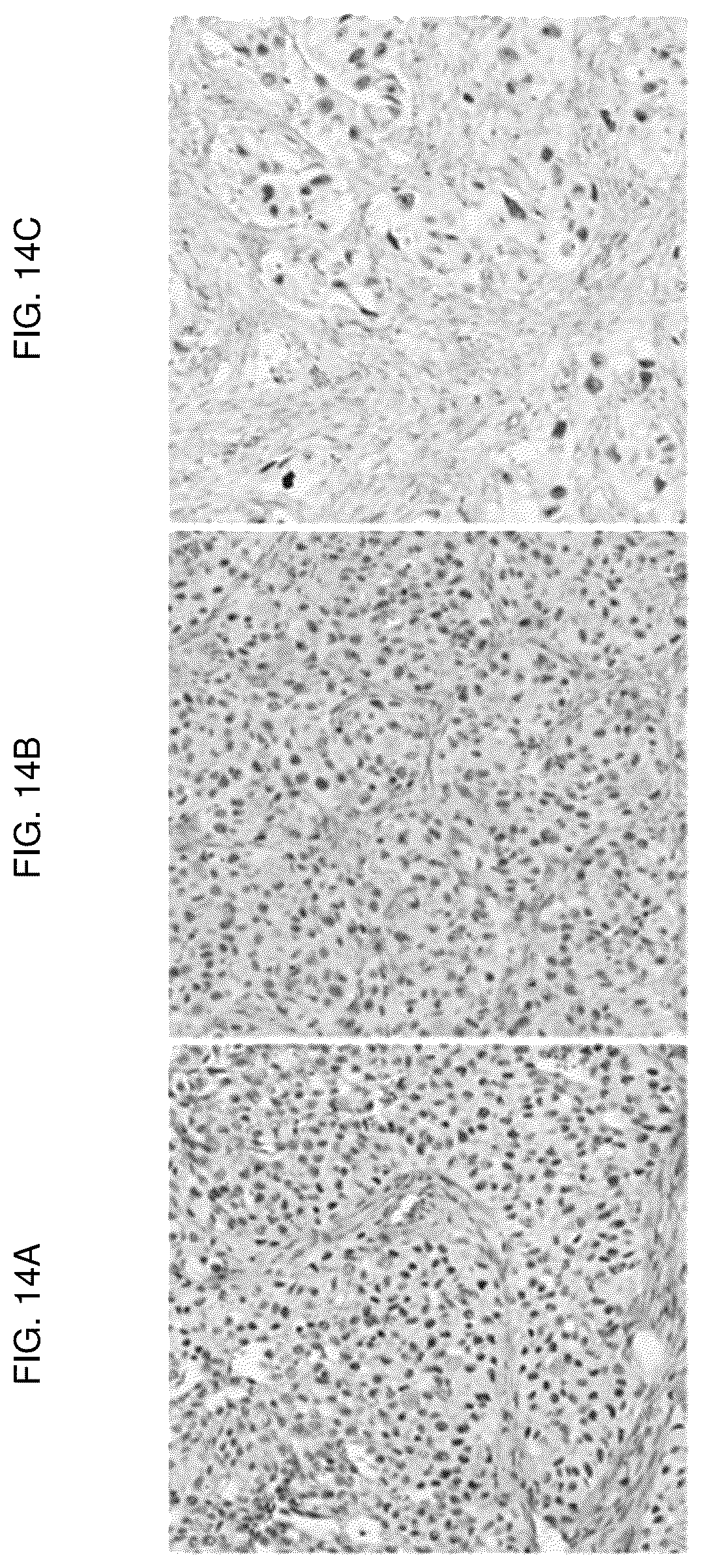 Patent US12617848 Figure 14 – Methods of treating ocular pathologies using bifunctional molecules that target growth factors