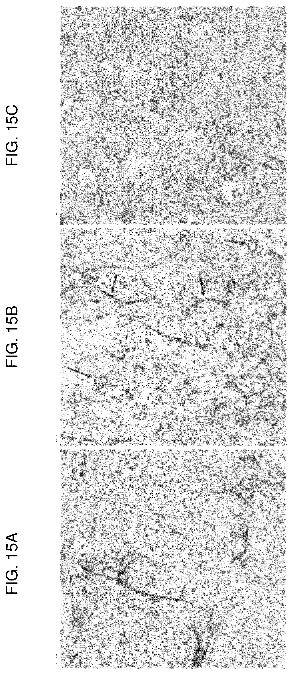 Patent US12617848 Figure 15 – Methods of treating ocular pathologies using bifunctional molecules that target growth factors