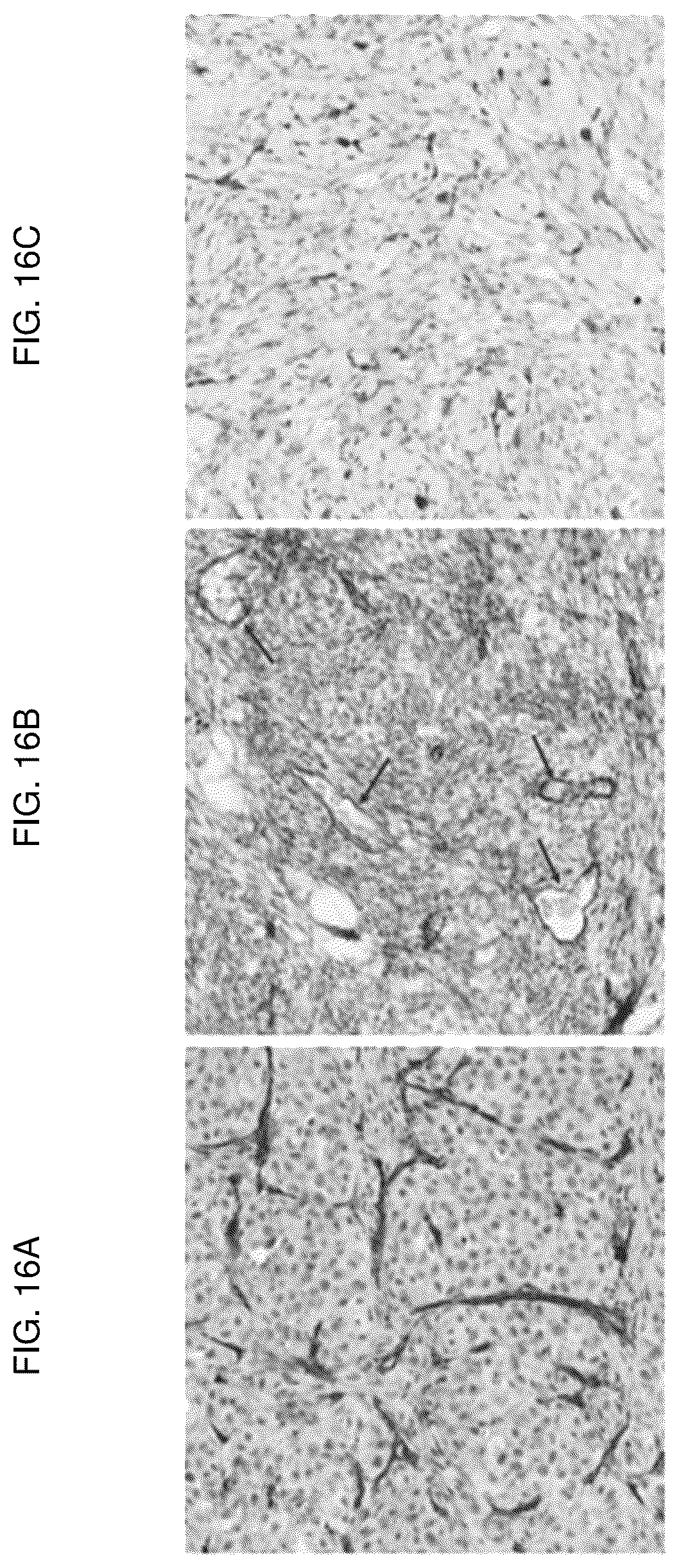 Patent US12617848 Figure 16 – Methods of treating ocular pathologies using bifunctional molecules that target growth factors