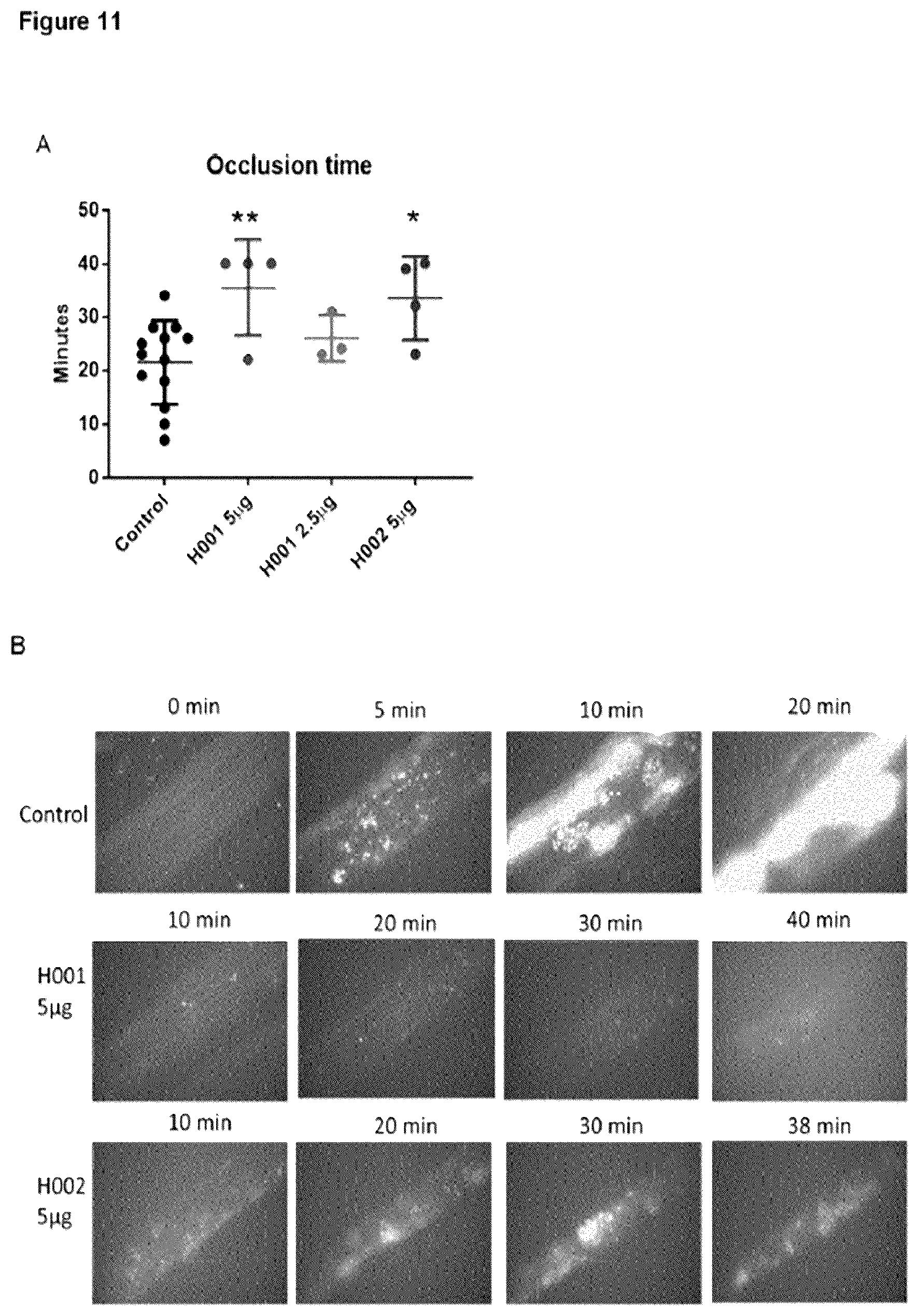 Patent US12617863 Figure 11 – Humanized anti-glycoprotein Ib alpha (GPIbalpha) antibodies