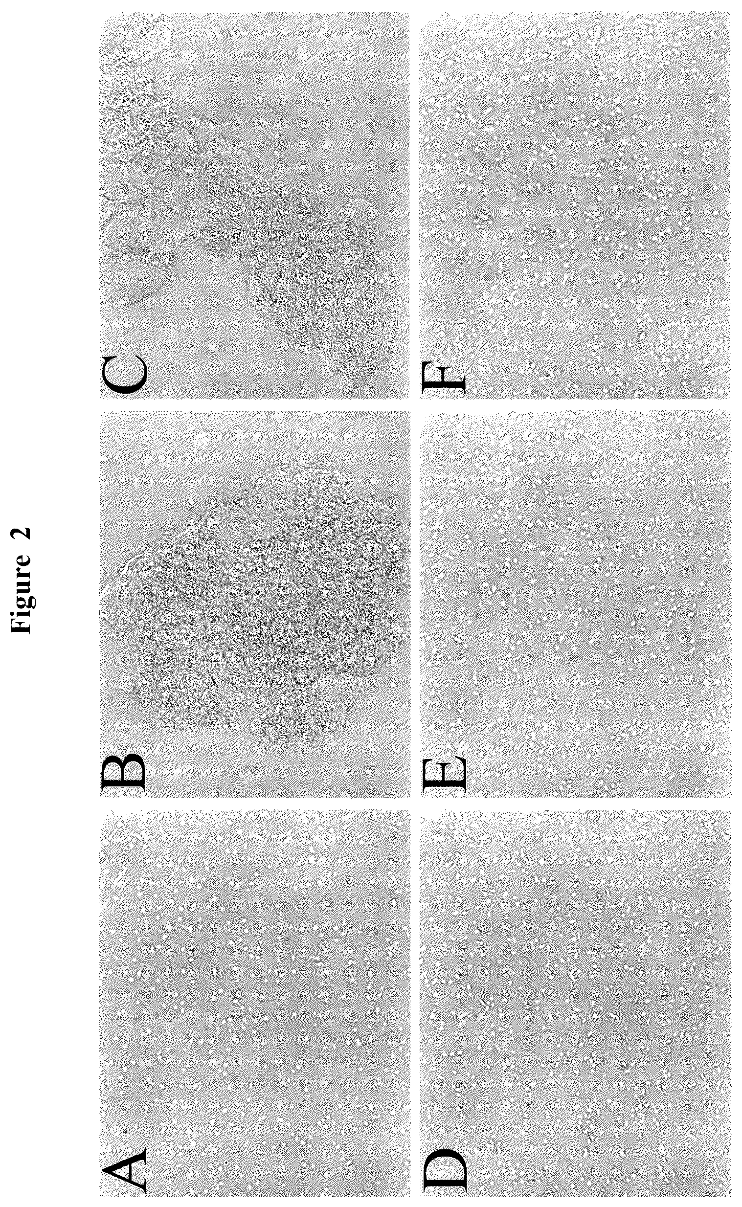 Patent US12617868 Figure 2 – Activation of (Na + +K + )-ATPase inhibits platelet aggregation and prevents thrombosis