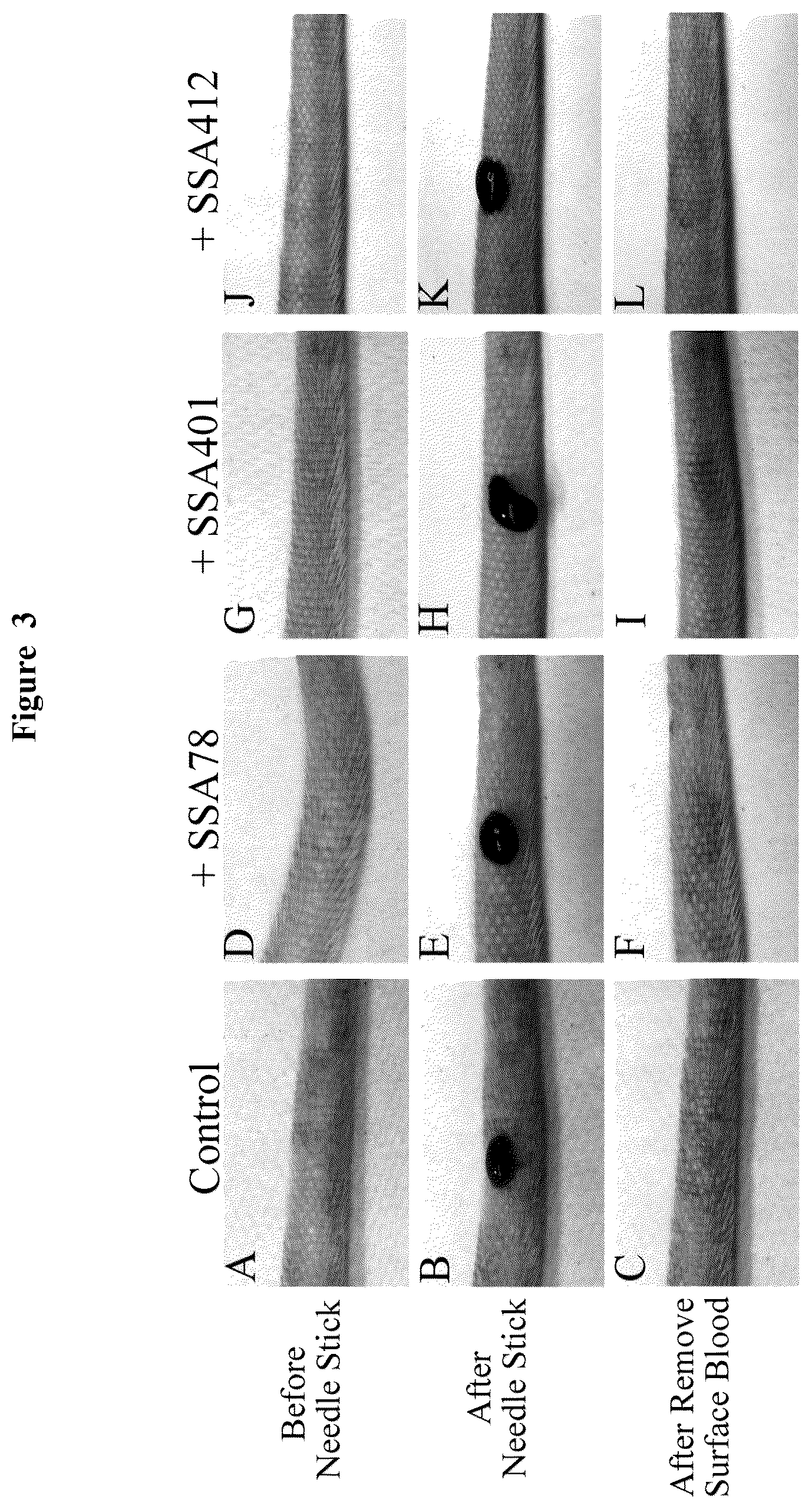 Patent US12617868 Figure 3 – Activation of (Na + +K + )-ATPase inhibits platelet aggregation and prevents thrombosis