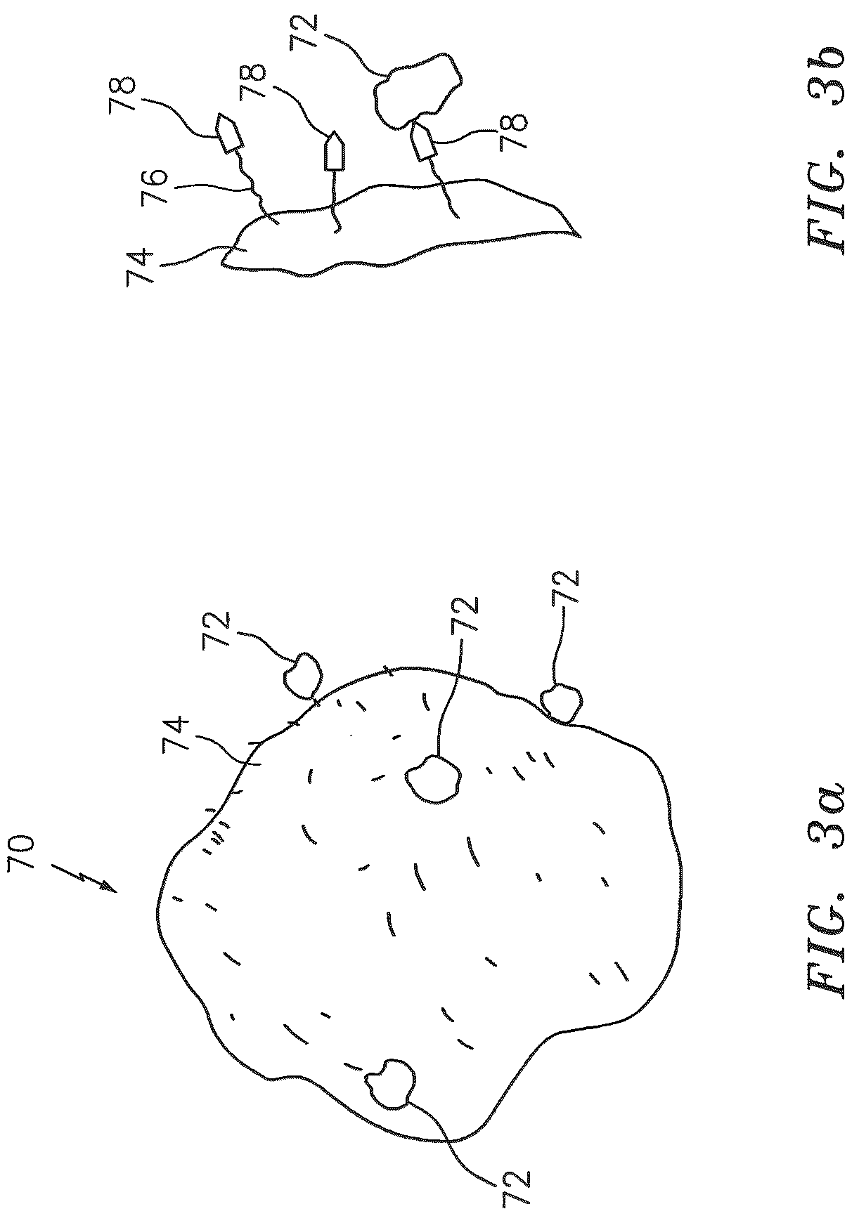 Patent US12618010 Figure 9 – Method and system for flotation separation in a magnetically controllable and steerable medium