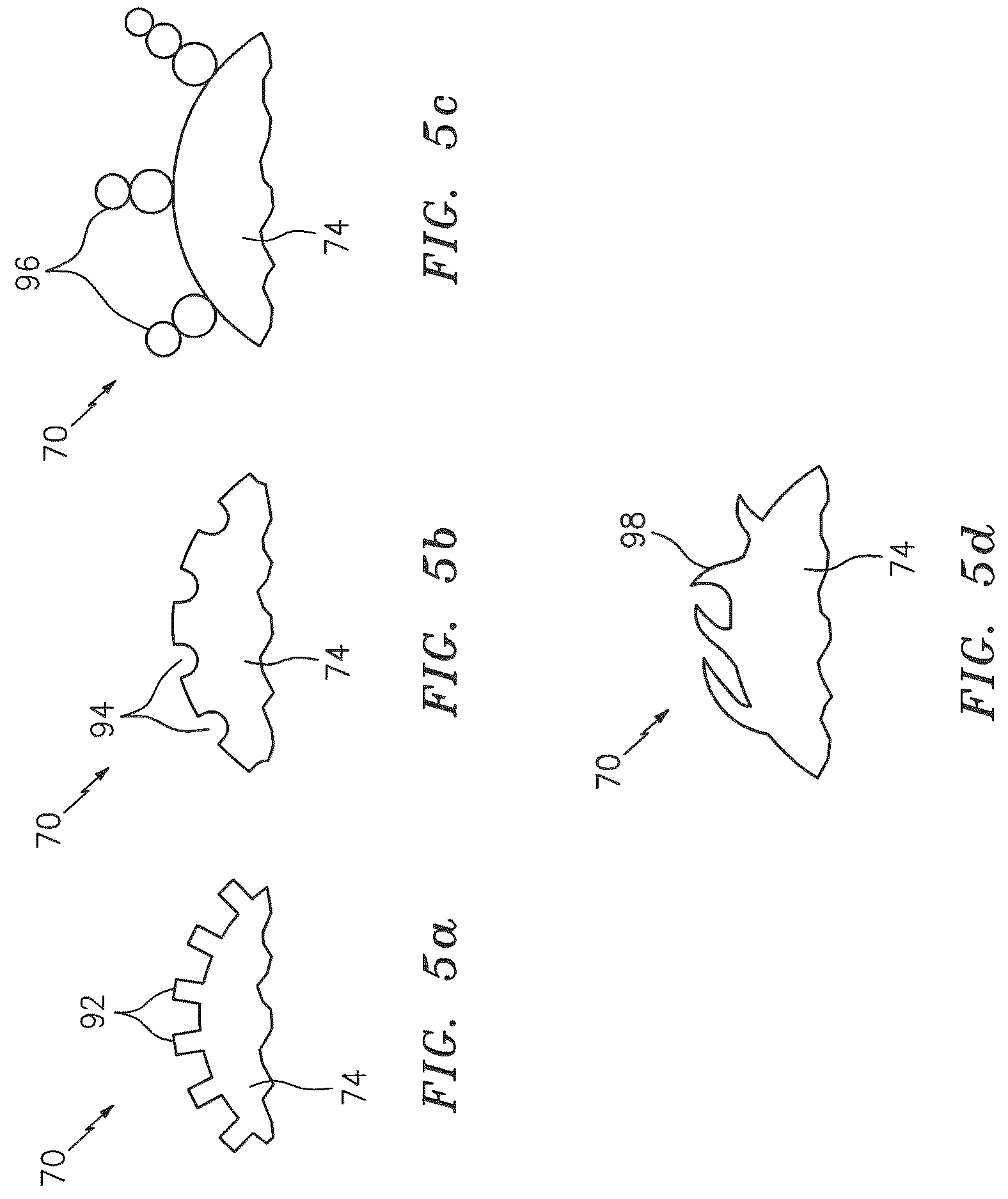 Patent US12618010 Figure 11 – Method and system for flotation separation in a magnetically controllable and steerable medium