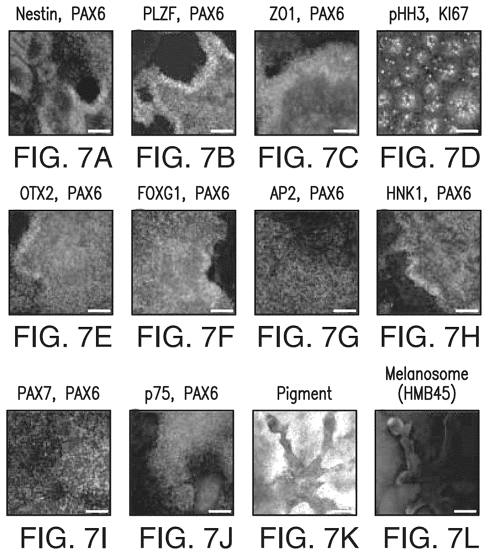 Patent US12618044 Figure 5 – Specification of functional cranial placode derivatives from human pluripotent stem cells