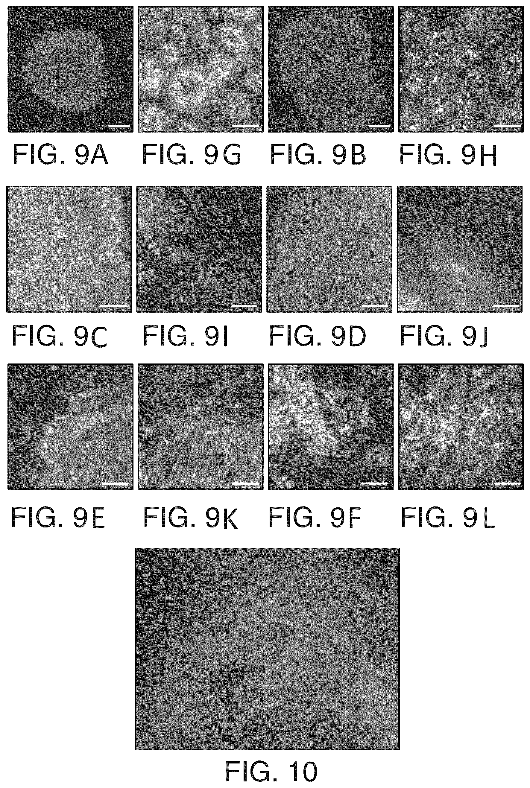 Patent US12618044 Figure 8 – Specification of functional cranial placode derivatives from human pluripotent stem cells