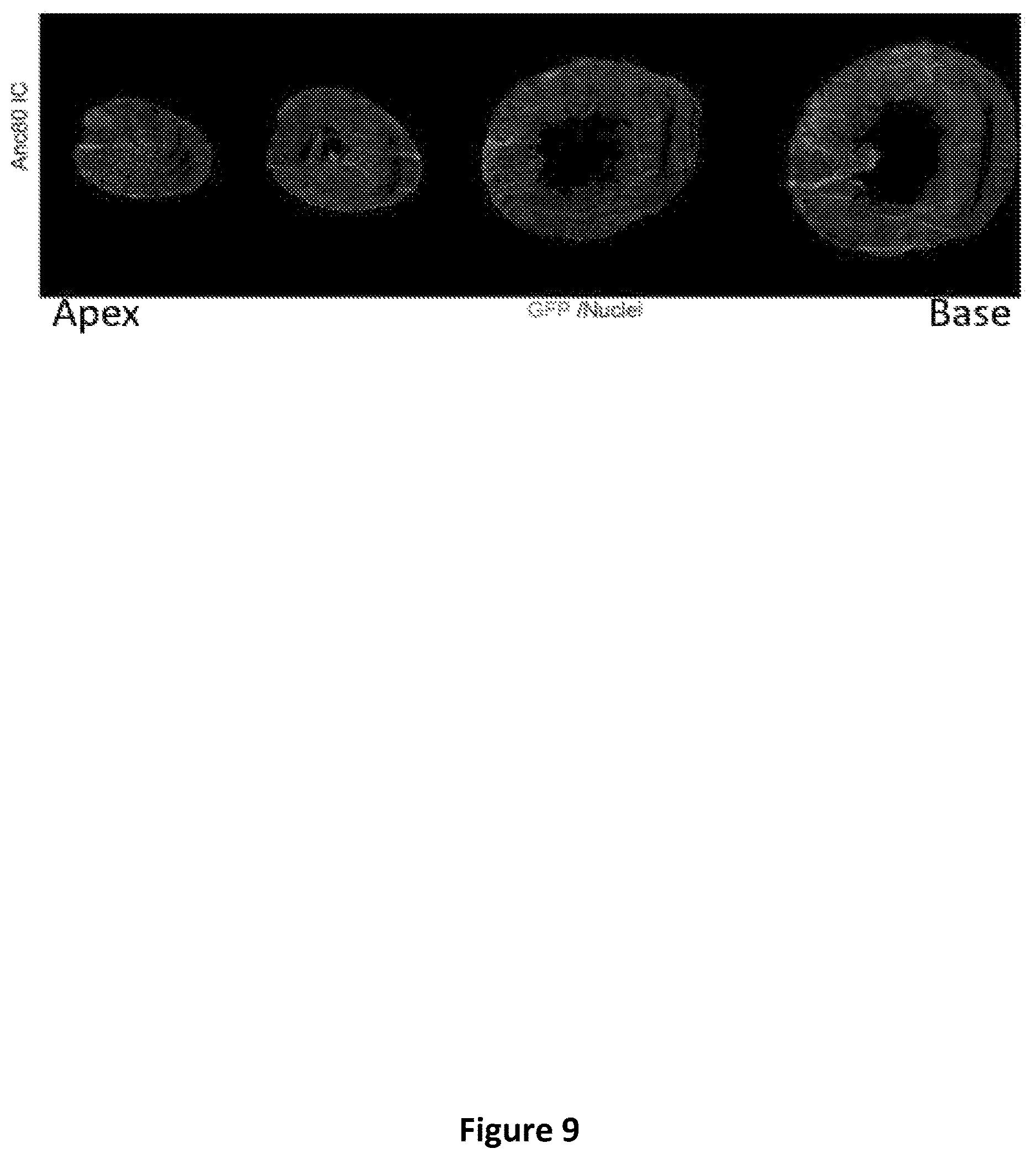 Patent US12618059 Figure 13 – Anc80 encoding sphingolipid-metabolizing proteins