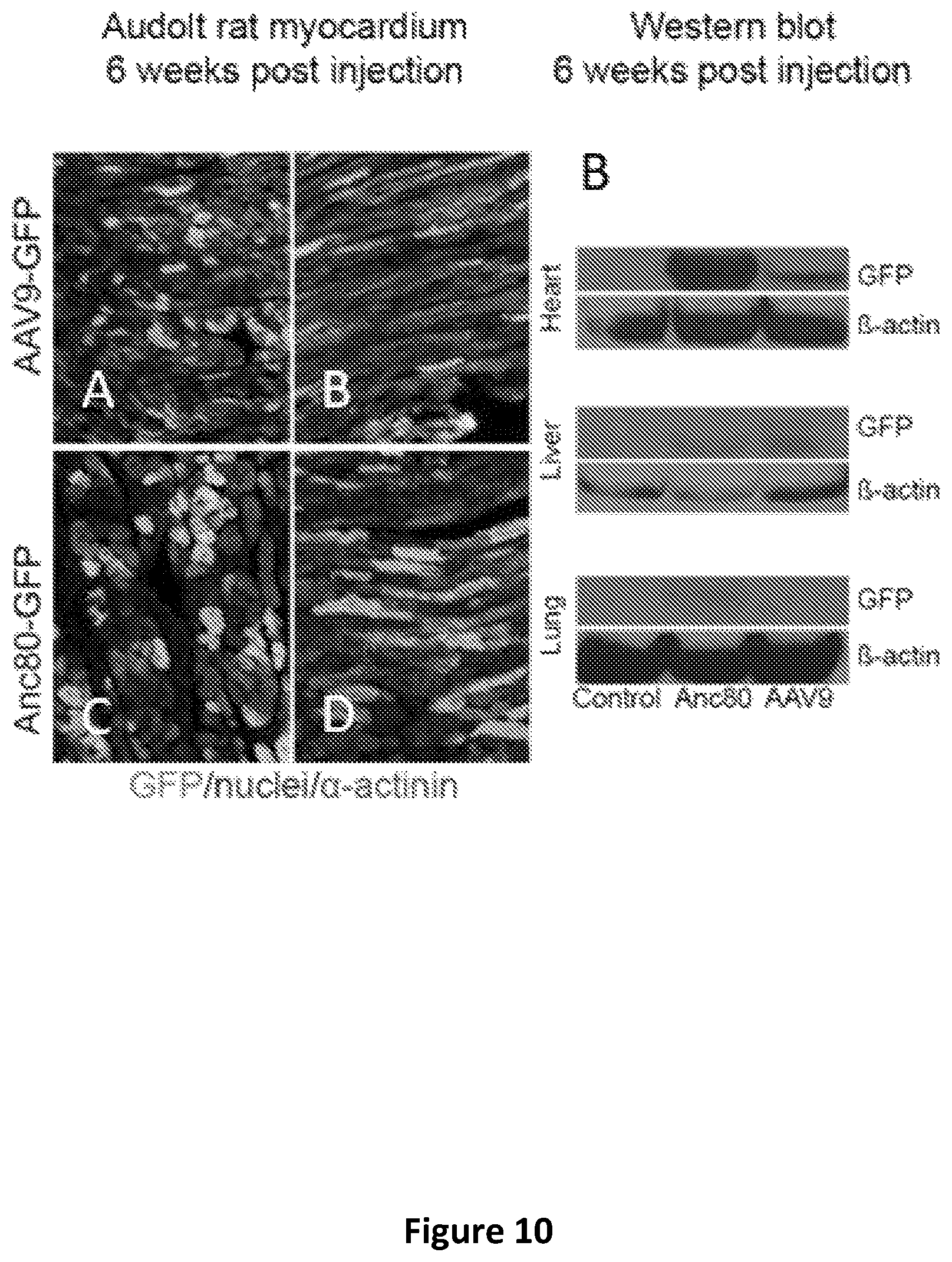 Patent US12618059 Figure 14 – Anc80 encoding sphingolipid-metabolizing proteins