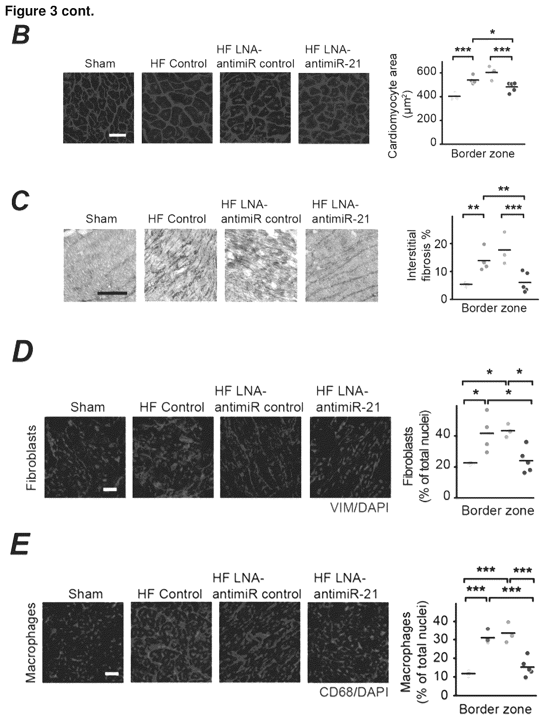 Patent US12618067 Figure 3 – Targeted delivery of an inhibitor of miR-21 to macrophages for the treatment of pulmonary fibrosis