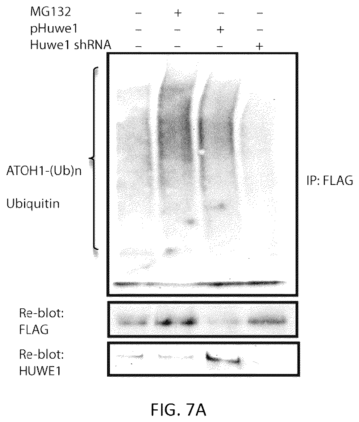 Patent US12618070 Figure 6 – Increasing Atoh1 life to drive sensorineural hair cell differentiation