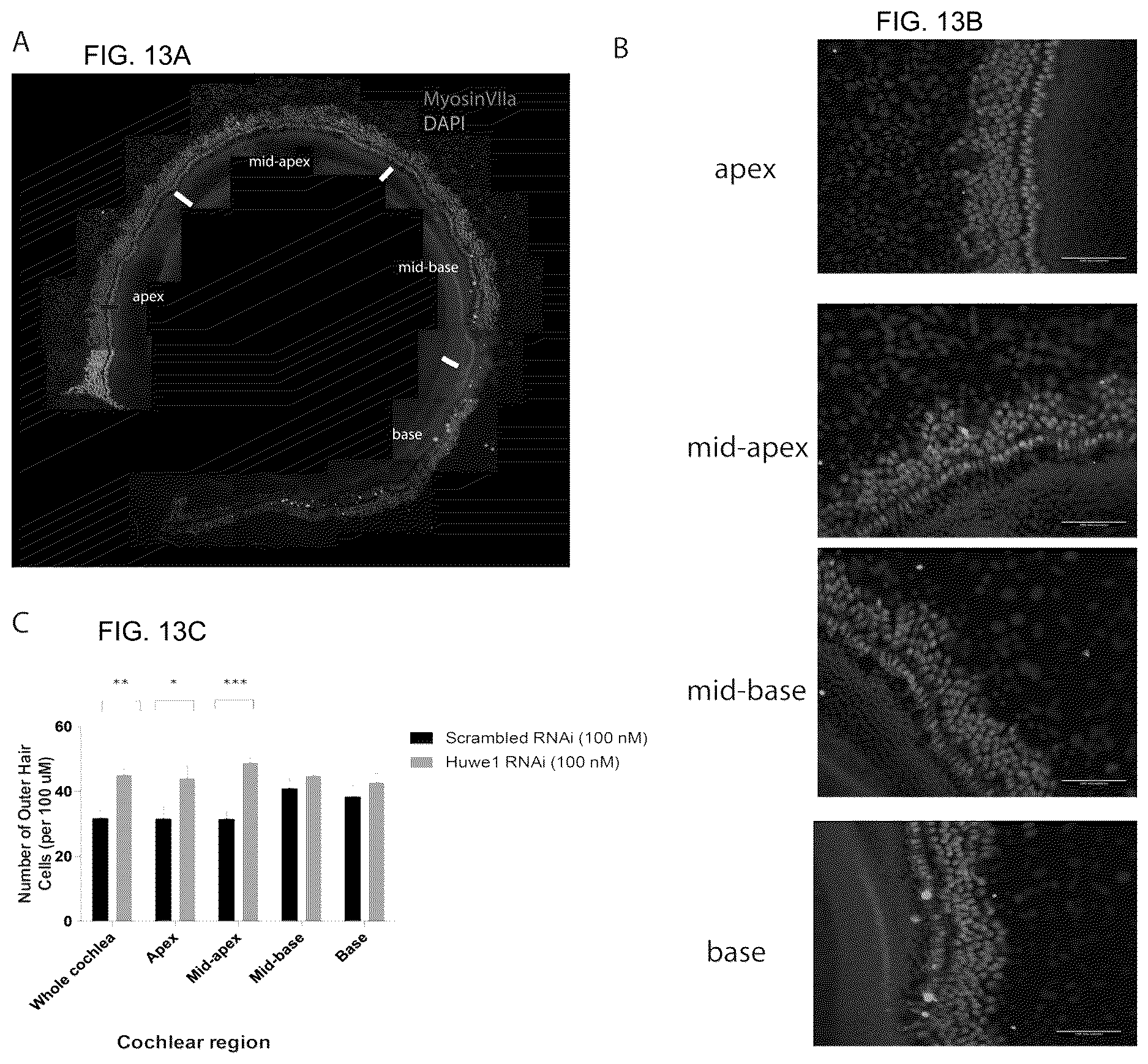 Patent US12618070 Figure 12 – Increasing Atoh1 life to drive sensorineural hair cell differentiation
