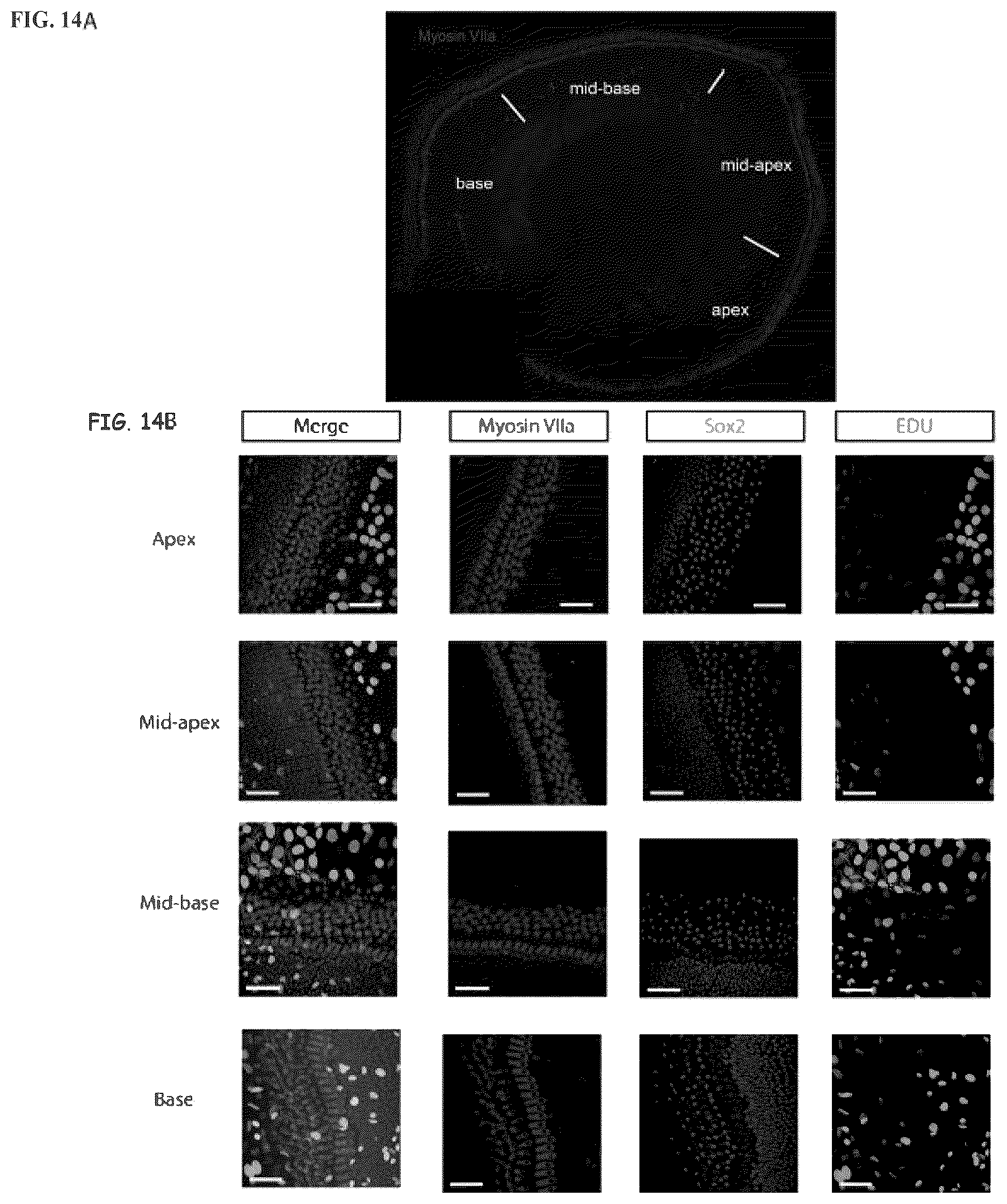 Patent US12618070 Figure 13 – Increasing Atoh1 life to drive sensorineural hair cell differentiation