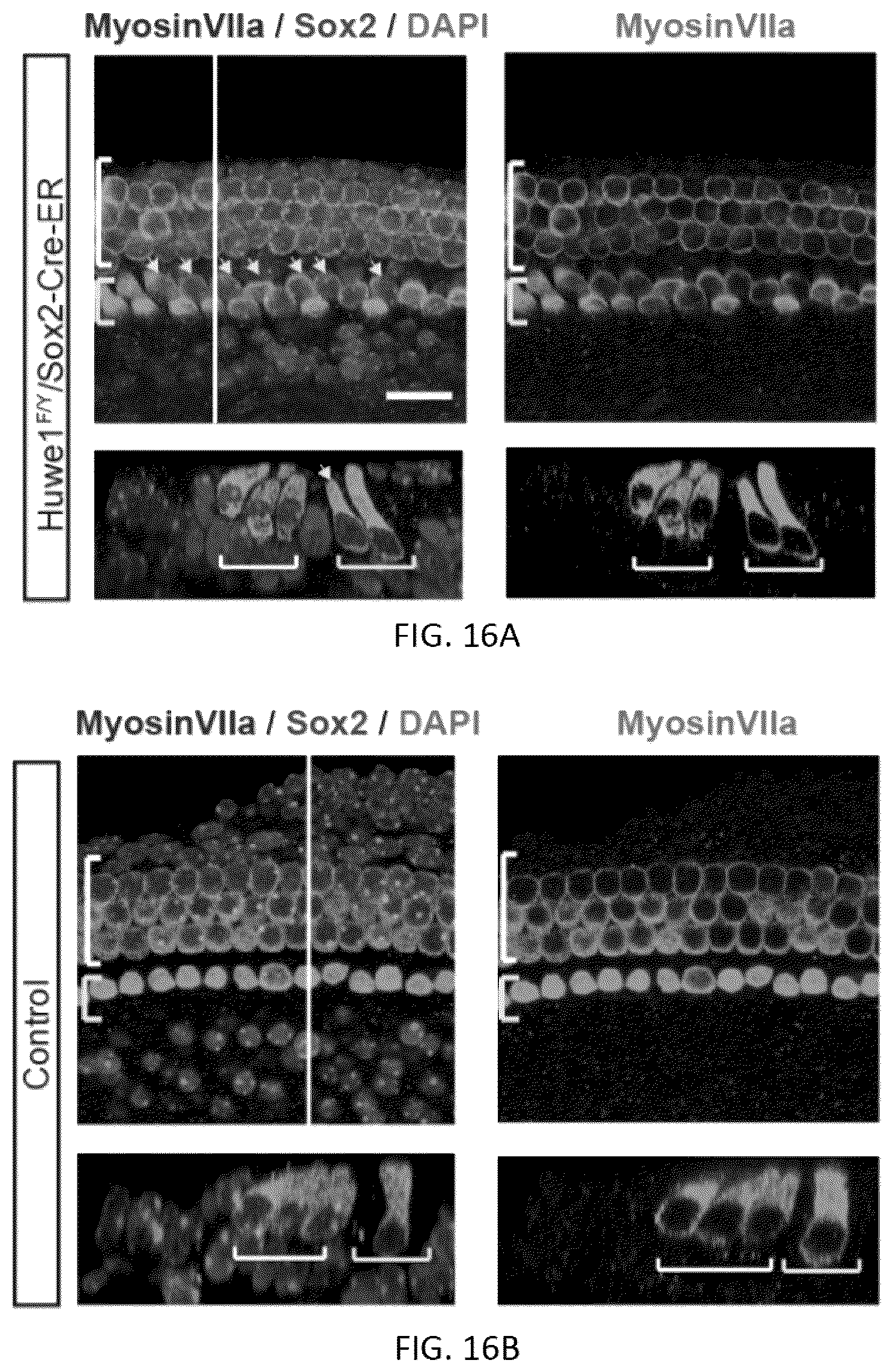 Patent US12618070 Figure 15 – Increasing Atoh1 life to drive sensorineural hair cell differentiation