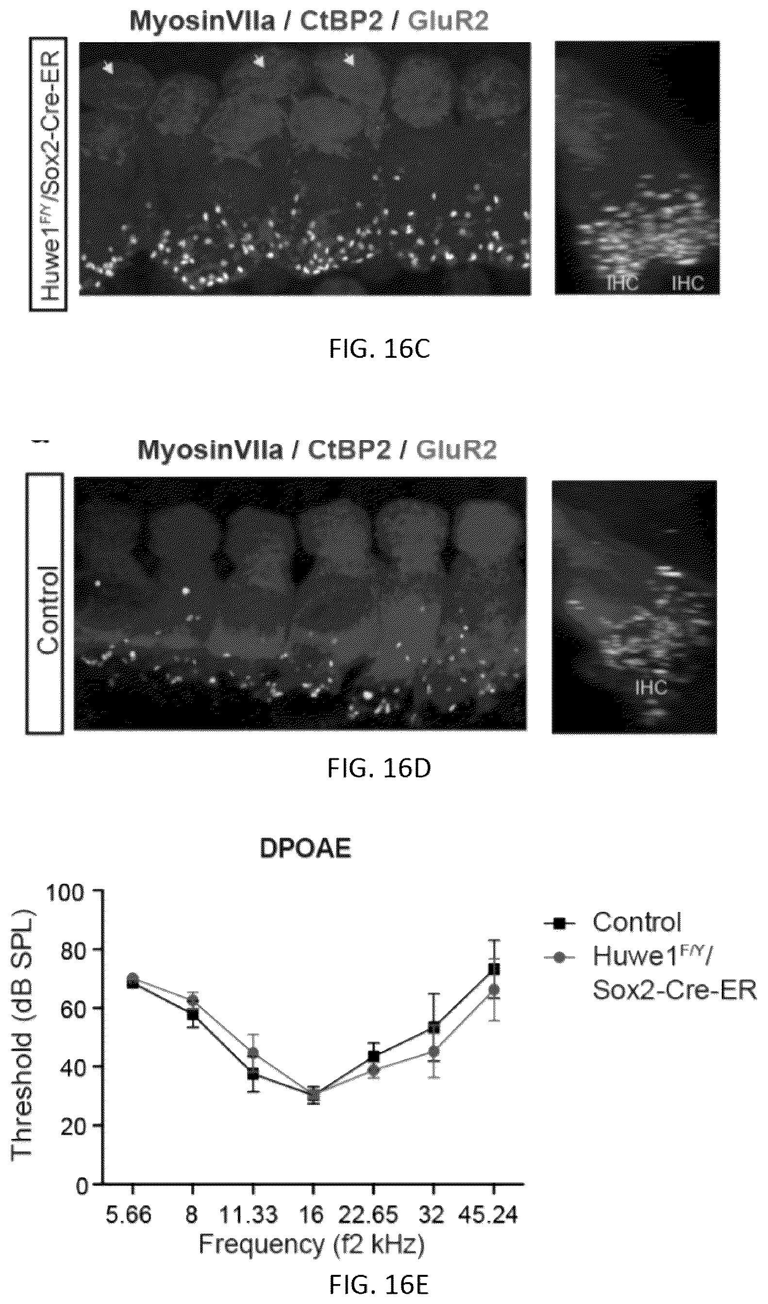 Patent US12618070 Figure 16 – Increasing Atoh1 life to drive sensorineural hair cell differentiation