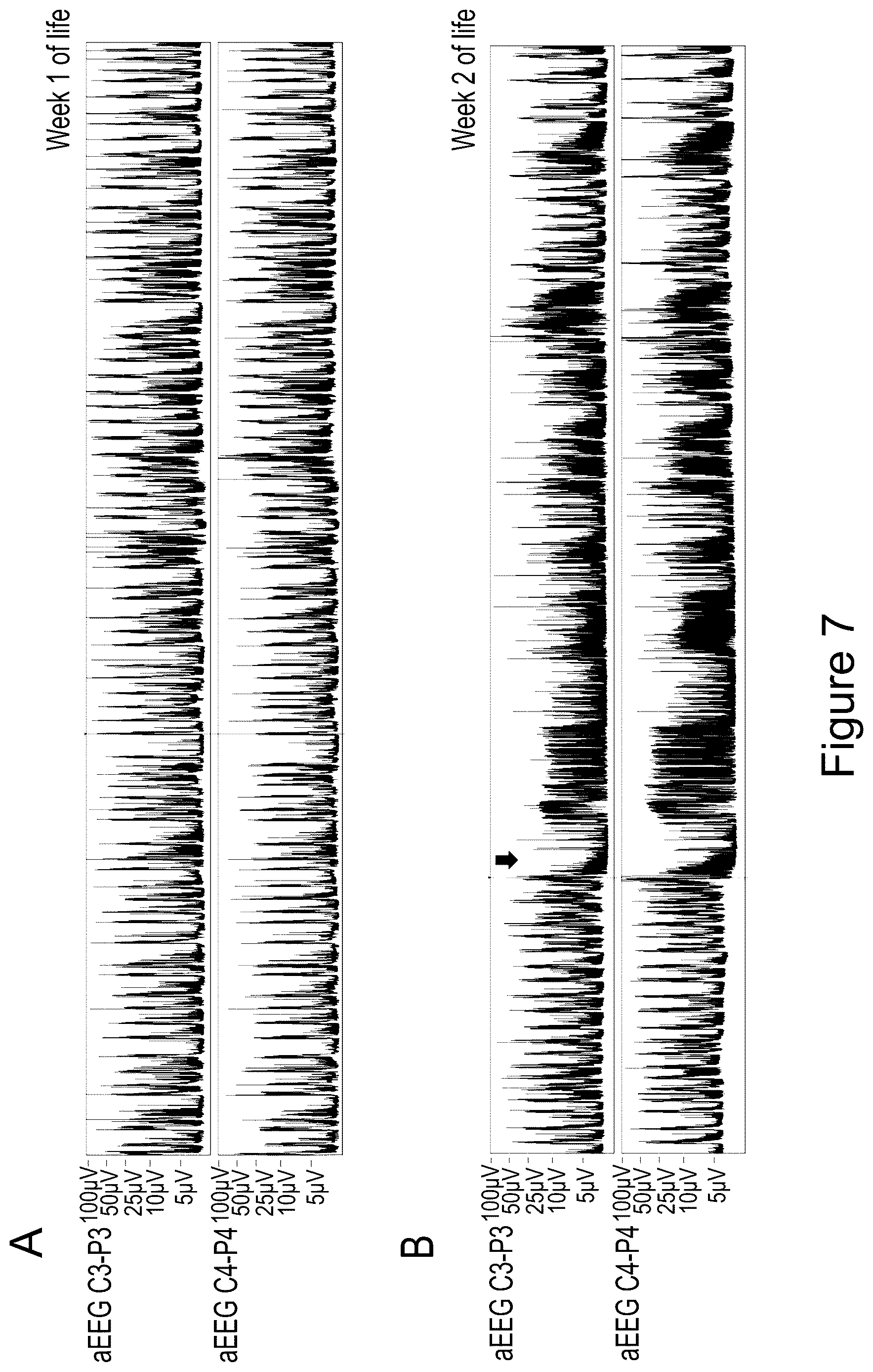 Patent US12618072 Figure 14 – Methods of treatment of SCN2A-related disorders