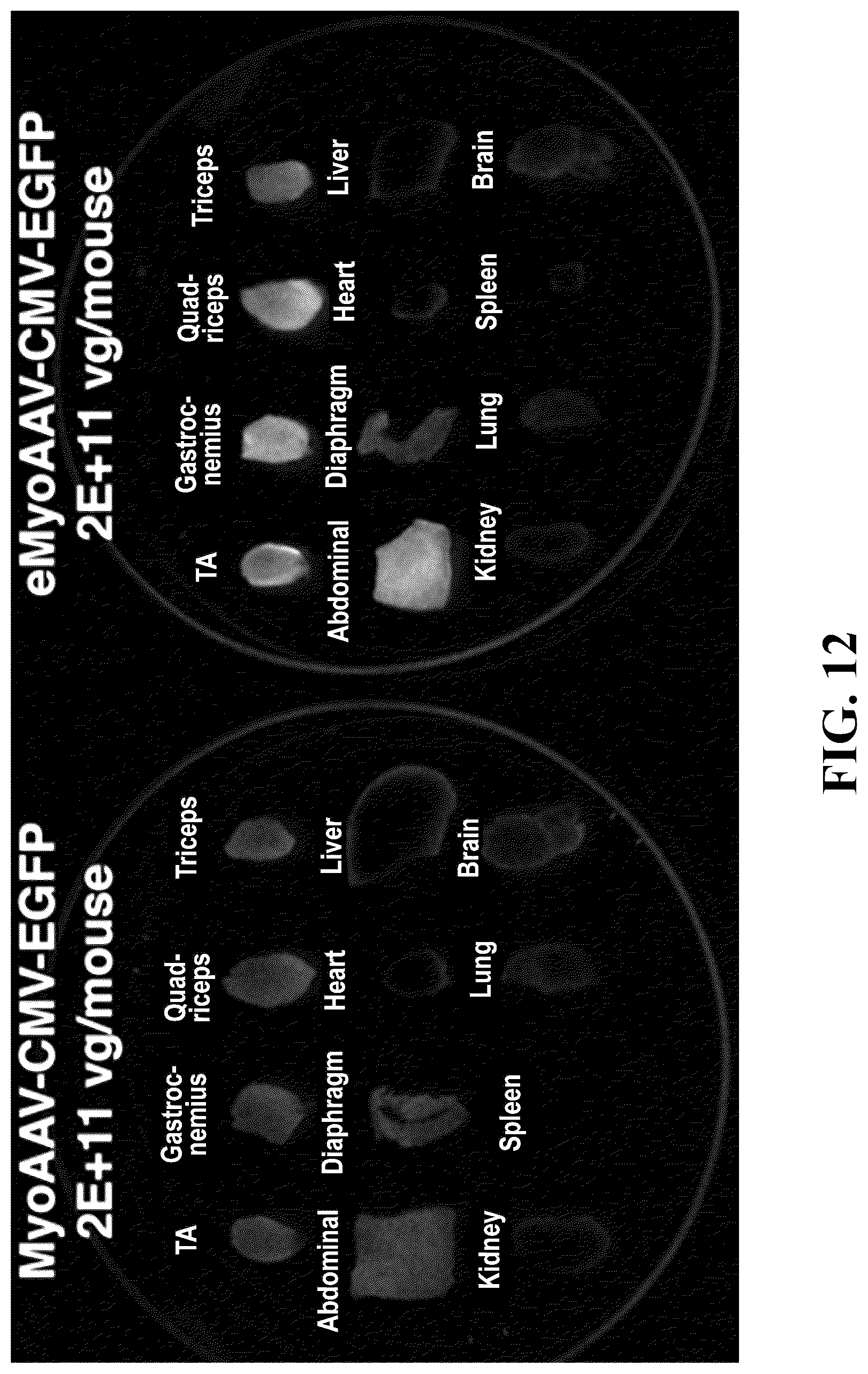 Patent US12618082 Figure 12 – Engineered muscle targeting compositions