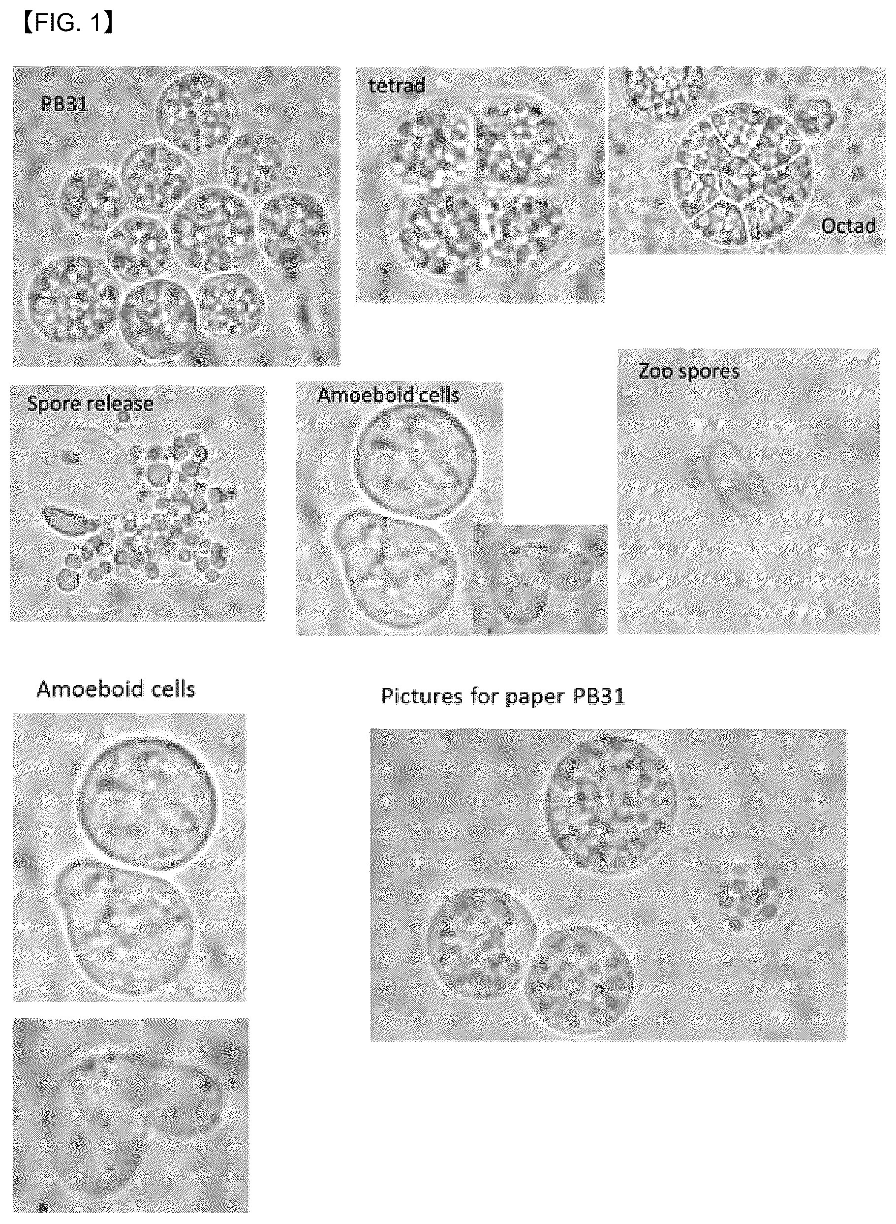 Patent US12618087 — Thraustochytrid strain genetically engineered for the production of biomaterials including long-chain polyunsaturated fatty acids — Figure 1