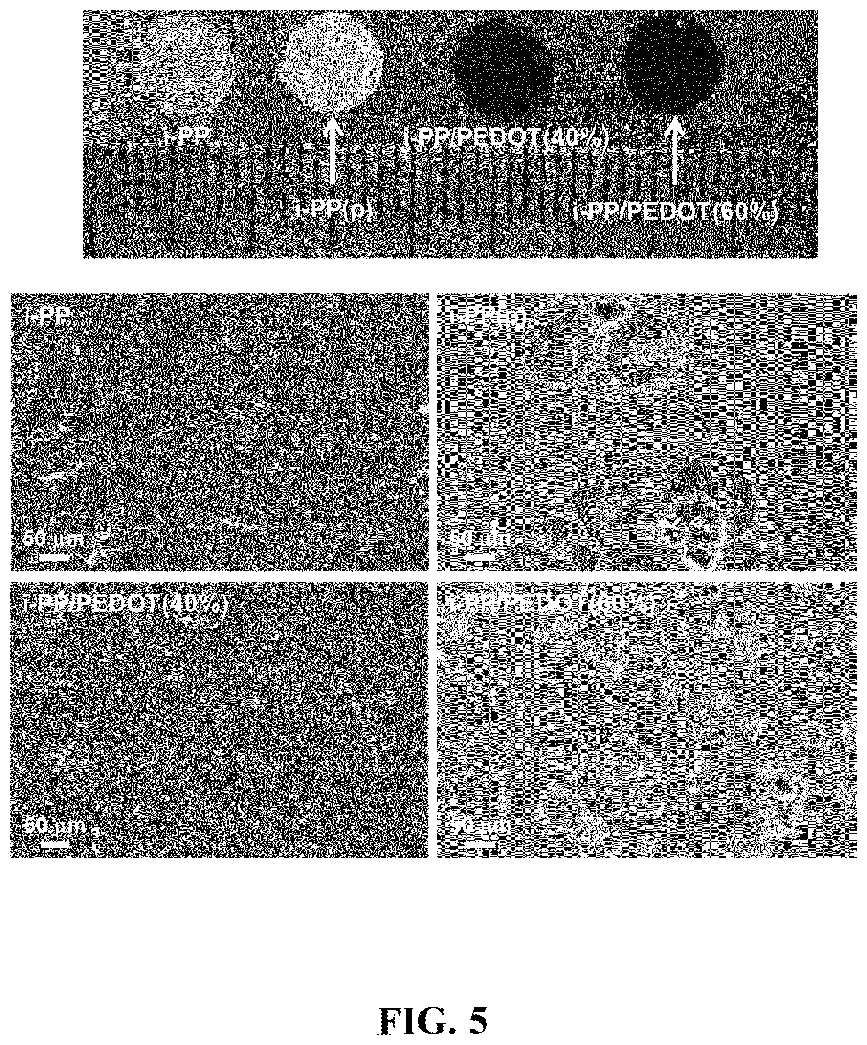 Patent US12618093 Figure 5 – Method, an electrochemical sensor and a system for selective detection of infections