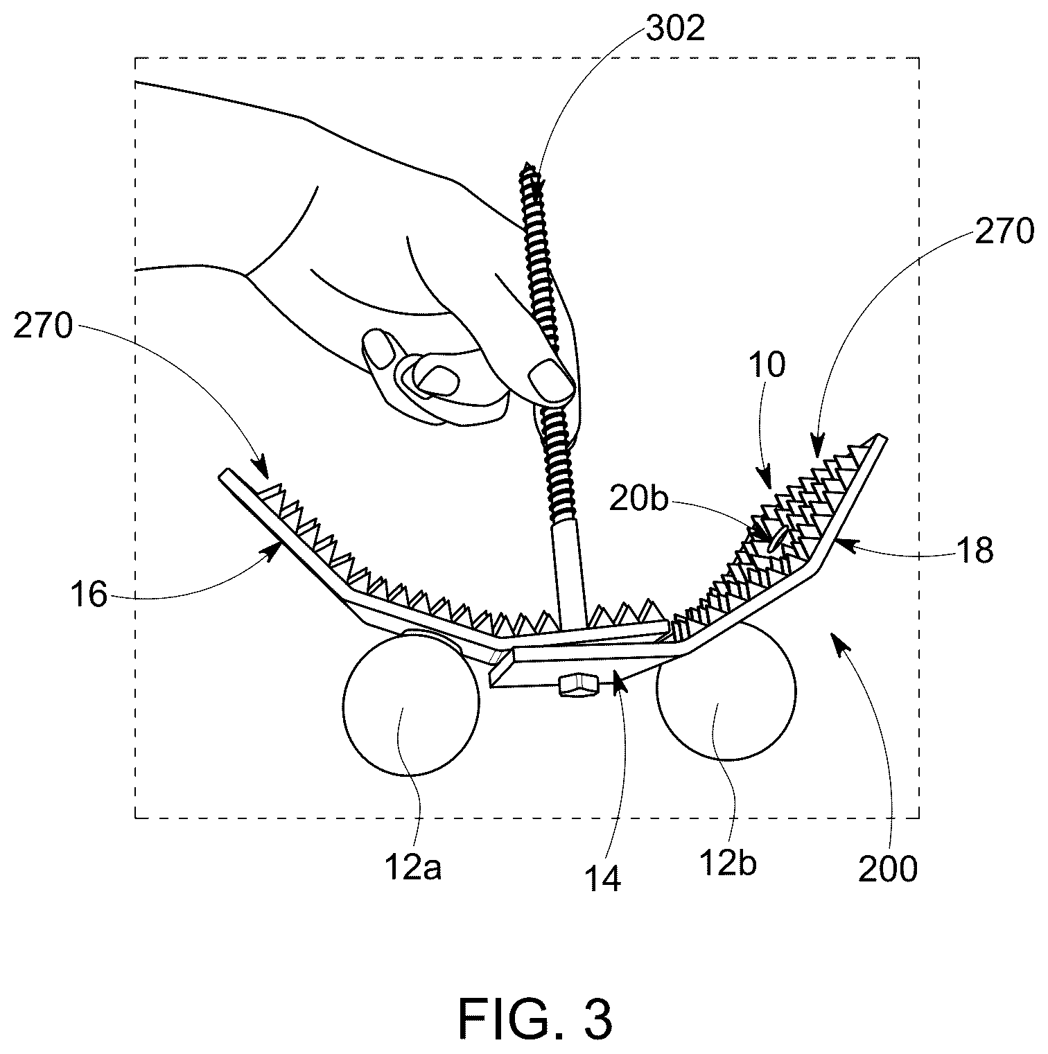 Patent US12618263 Figure 3 – High tensile fence bracing system and attachment bracket devices