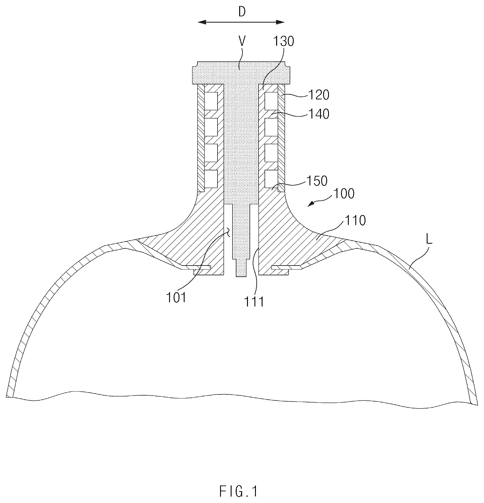 Patent US12618529 Figure 1 – Nozzle for pressure vessel and pressure vessel including the same