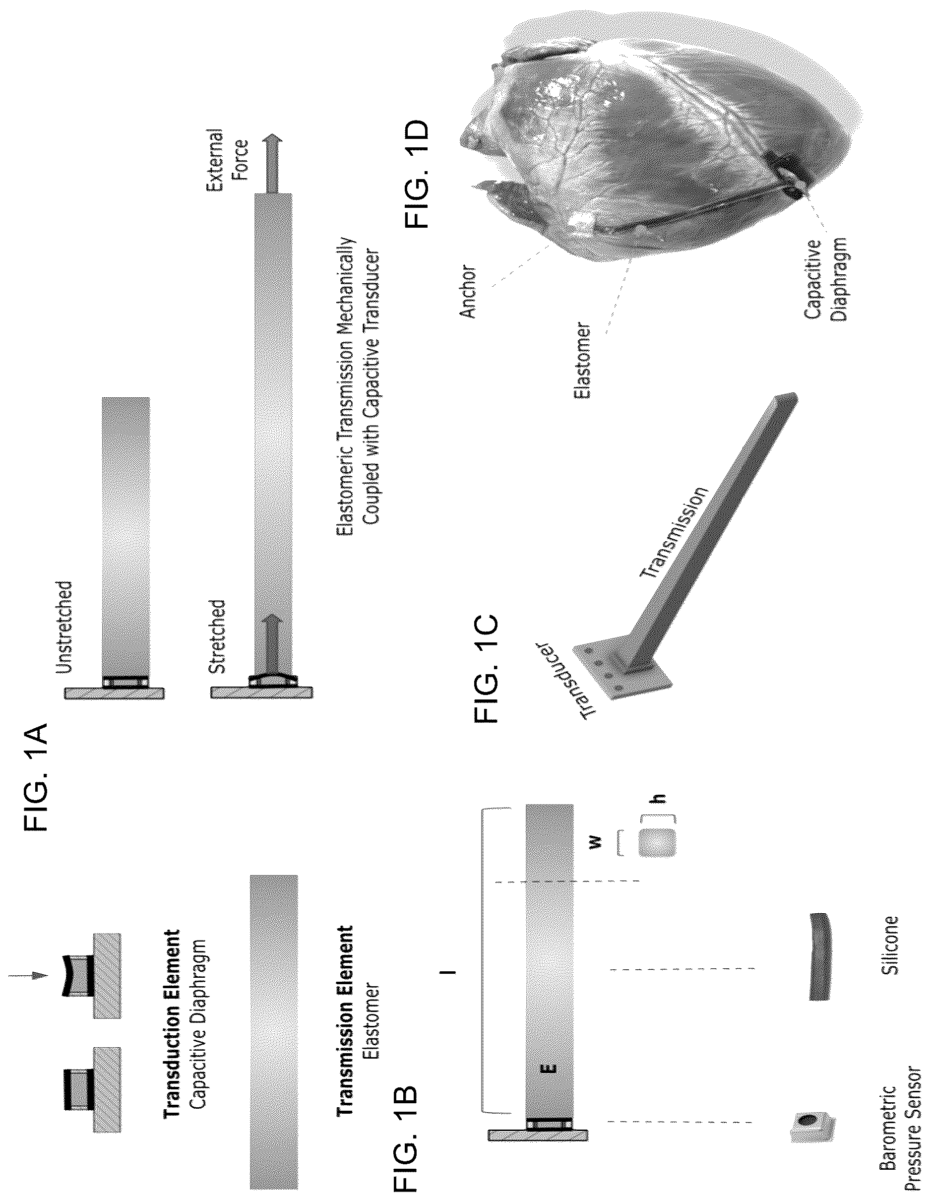 Patent US12618660 Figure 1 – Implantable, stretchable sensor for continuous biomechanical monitoring of the heart