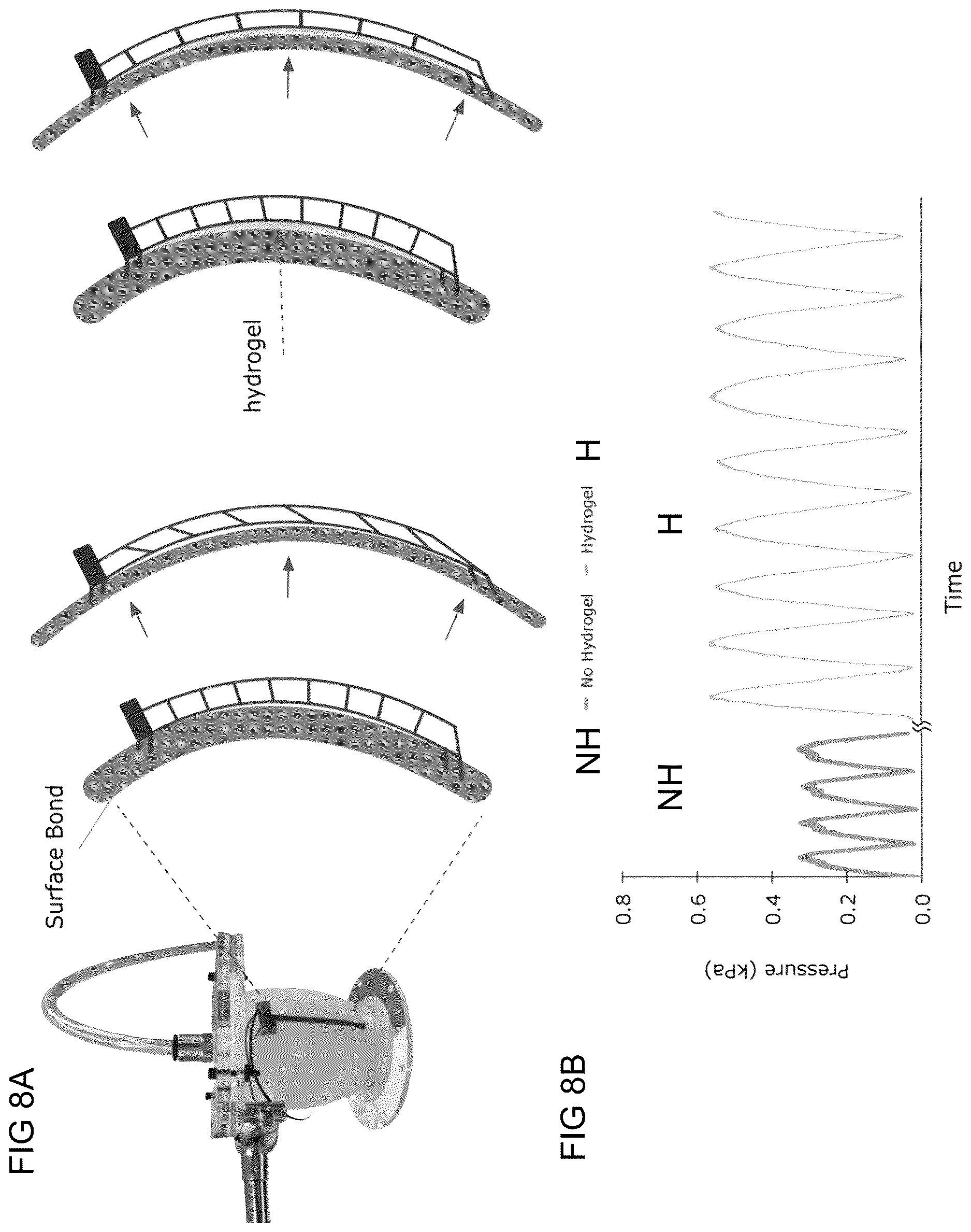 Patent US12618660 Figure 9 – Implantable, stretchable sensor for continuous biomechanical monitoring of the heart