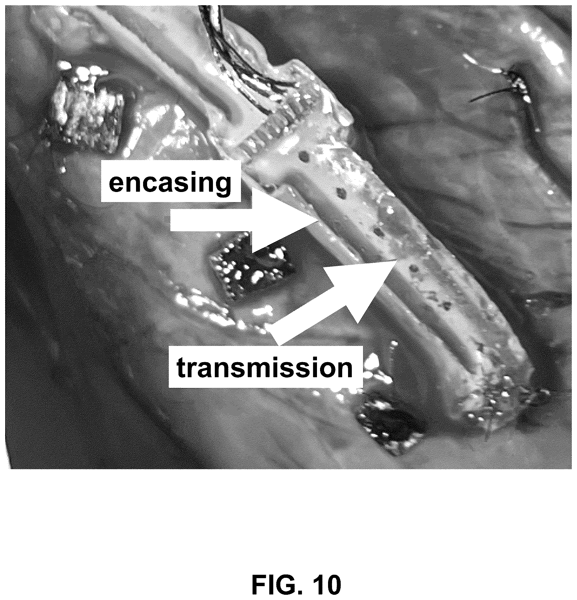 Patent US12618660 Figure 11 – Implantable, stretchable sensor for continuous biomechanical monitoring of the heart