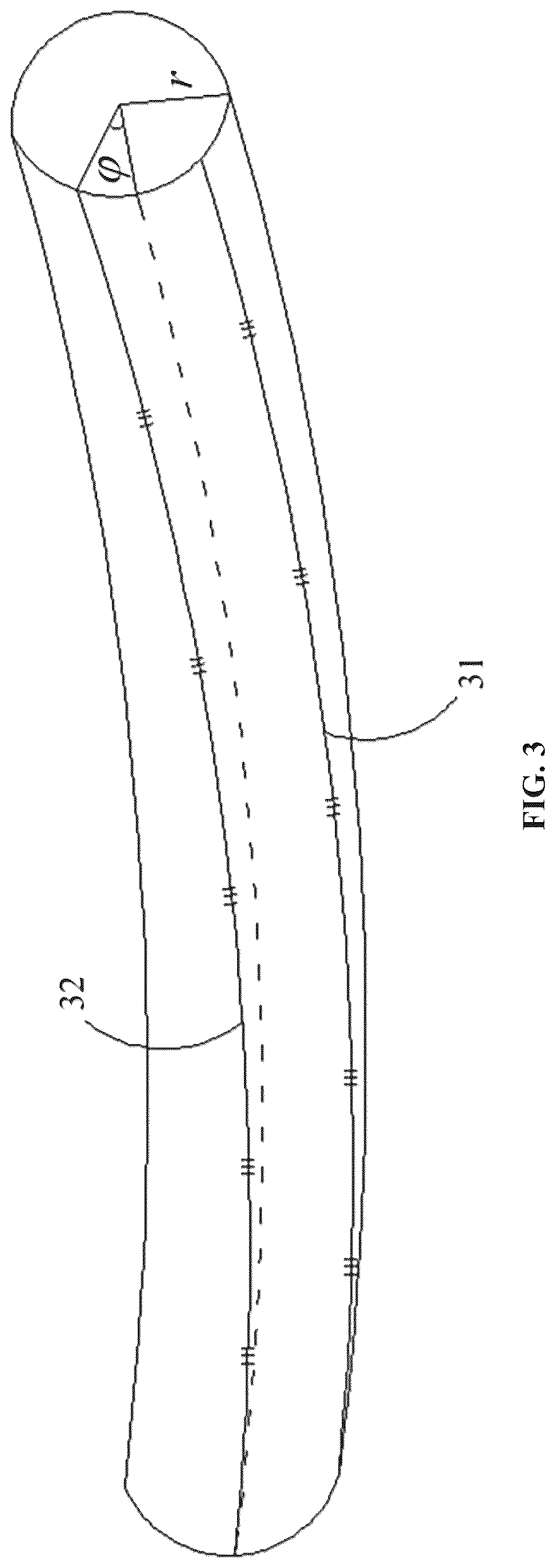 Patent US12618663 Figure 3 – Torsion compensation system and compensation method for fiber Bragg grating curvature sensor