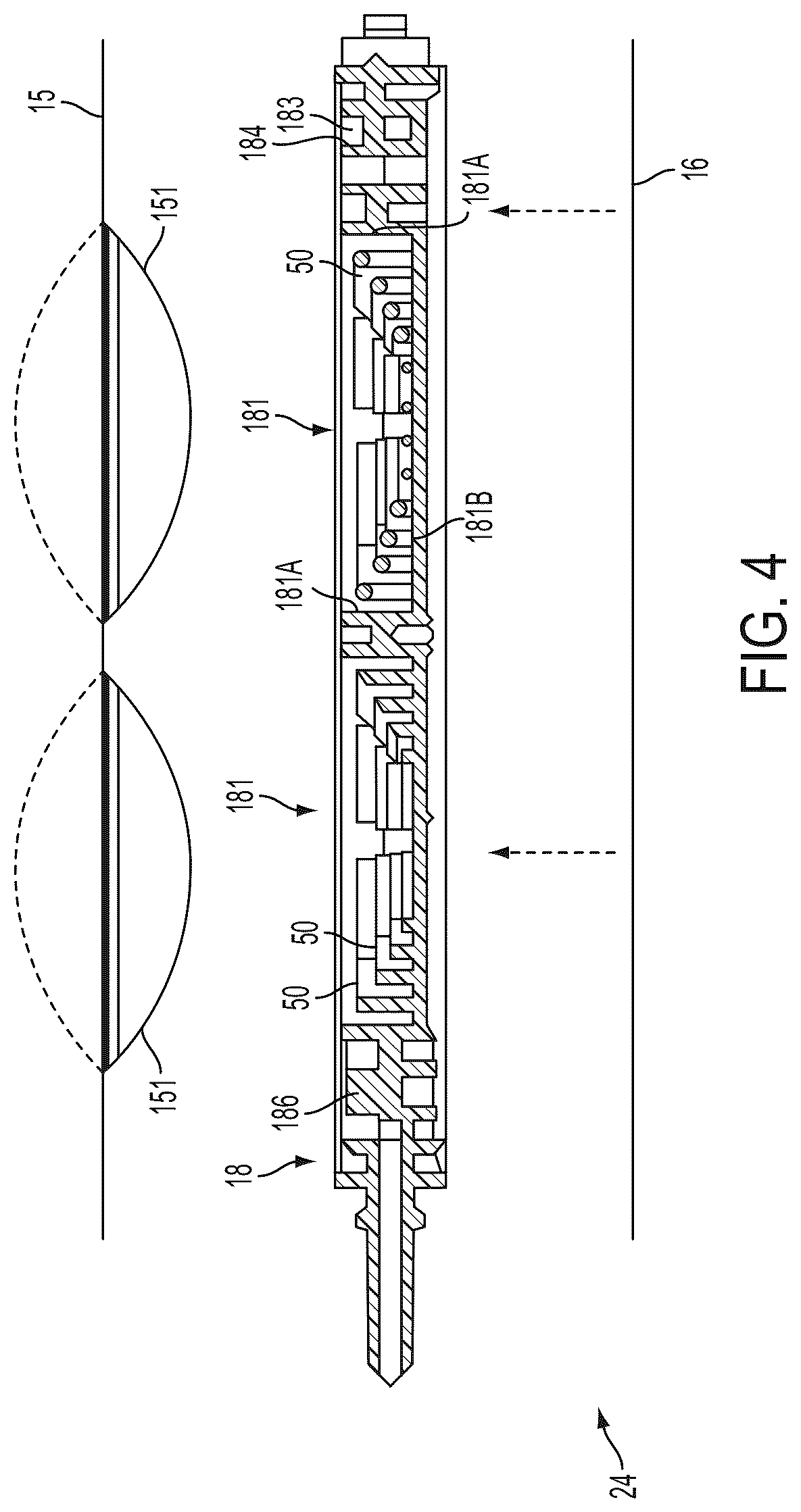 Patent US12618704 Figure 5 – Medical treatment system and methods using a plurality of fluid lines