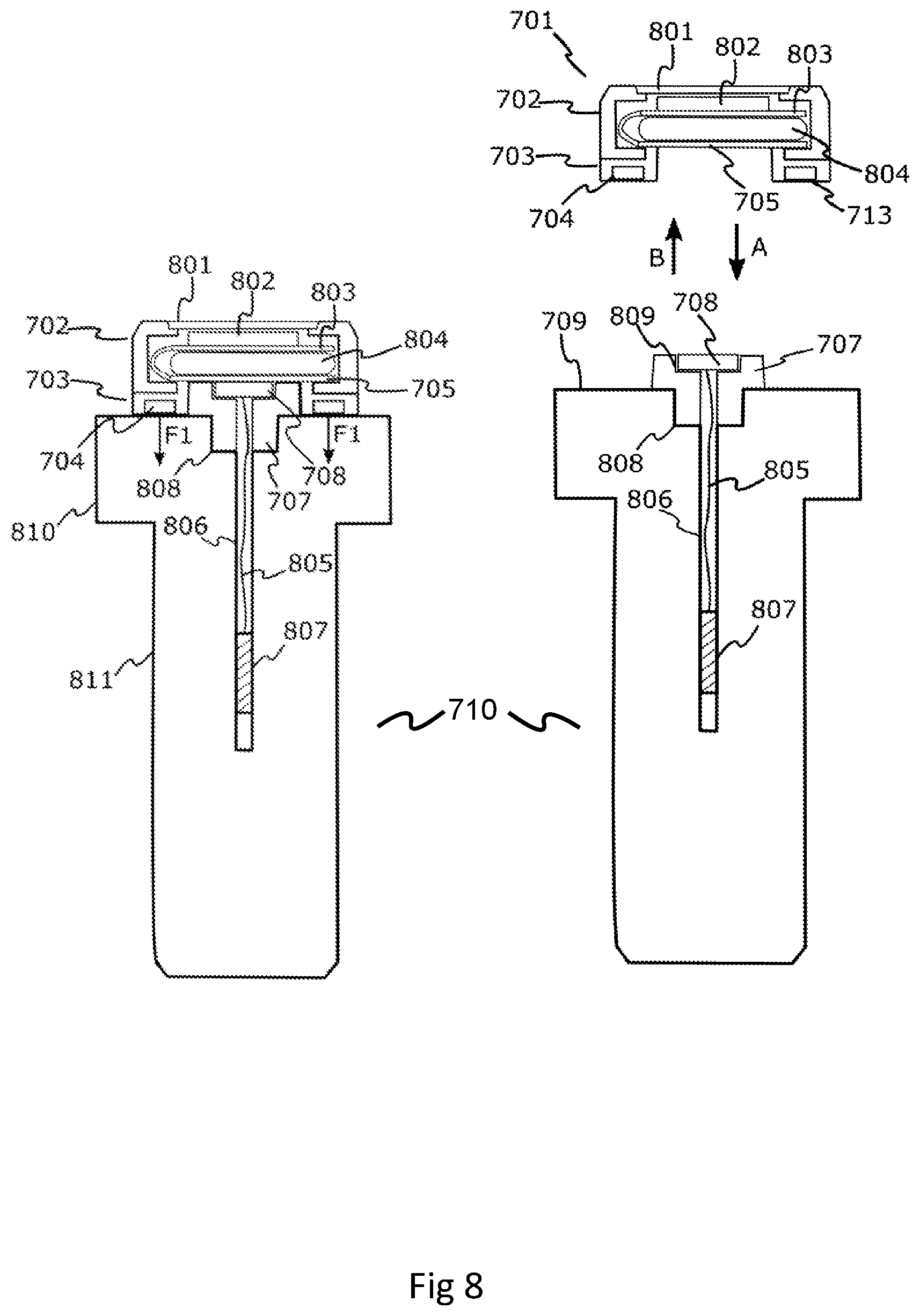 Patent US12618733 Figure 7 – Tension monitoring apparatus including a fixing with a shank under tension and a strain sensor embedded in the shank where the strain sensor is connected to a data processing means