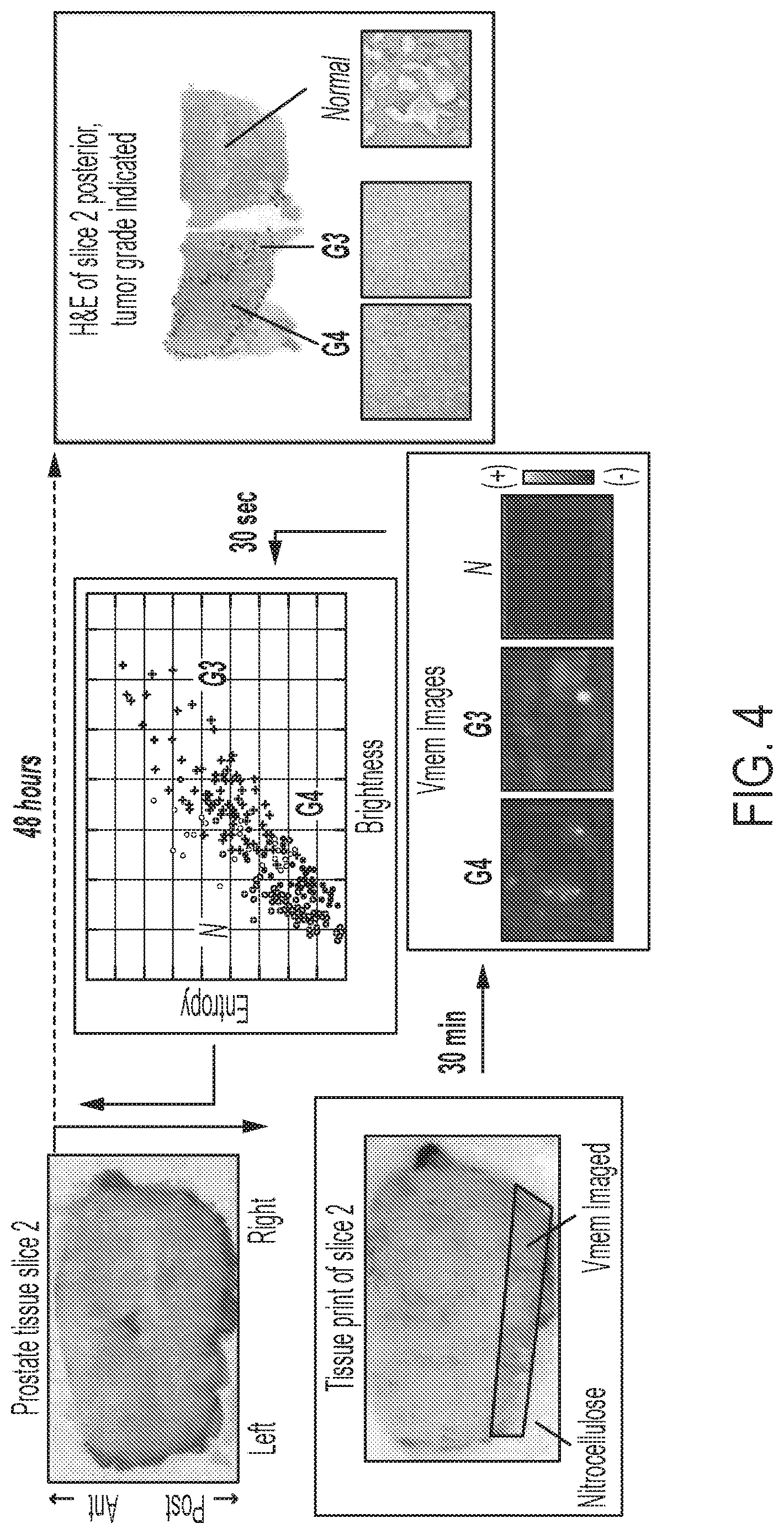 Patent US12618755 Figure 5 – Methods and systems for assessing bioelectric patterns