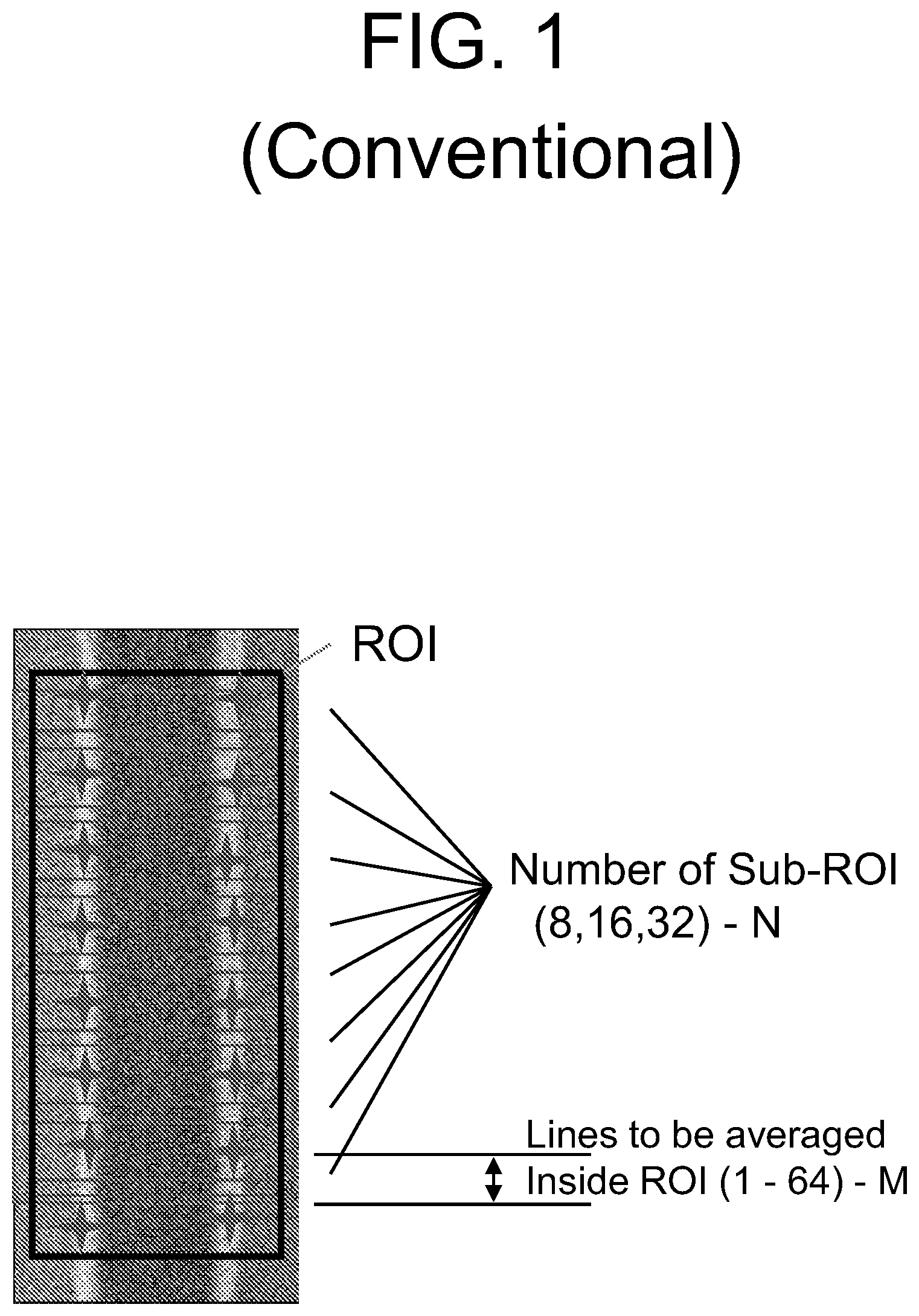 Patent US12618788 Figure 1 – System and method for denoising a region of interest of a pattern