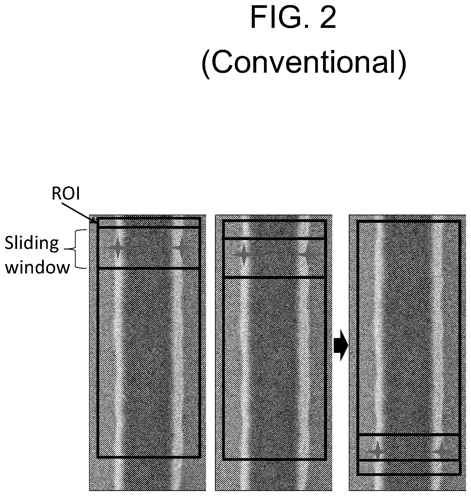 Patent US12618788 Figure 2 – System and method for denoising a region of interest of a pattern