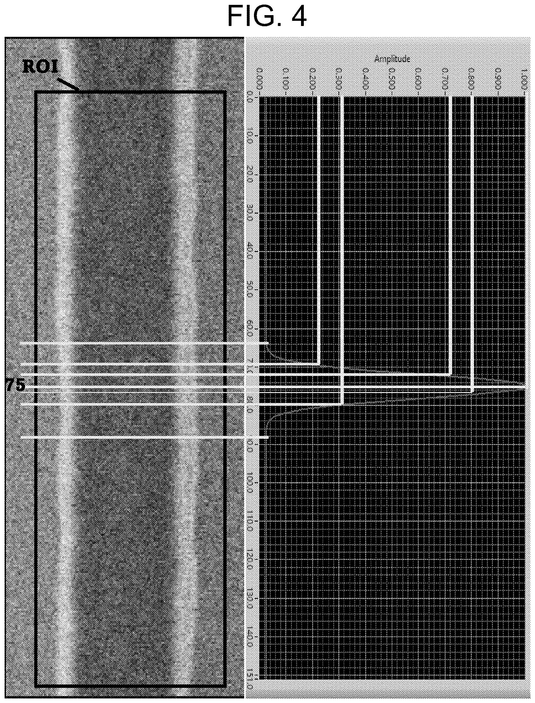 Patent US12618788 Figure 4 – System and method for denoising a region of interest of a pattern