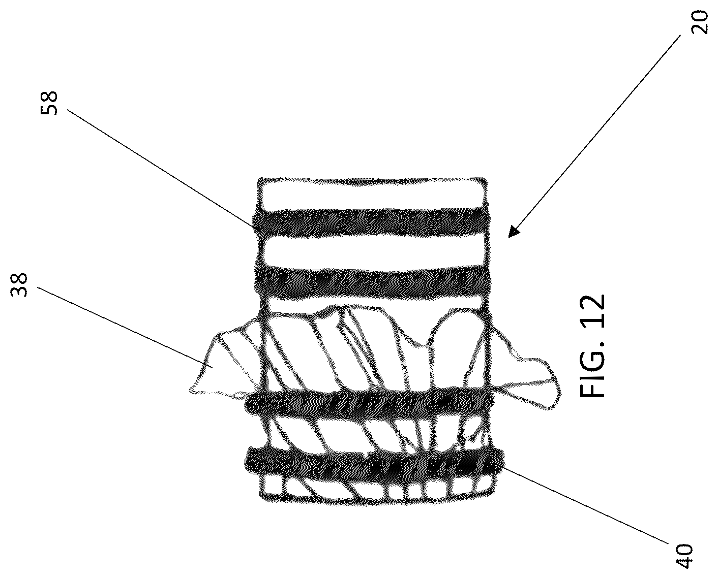 Patent US12618805 Figure 12 – System and method for real-time visualization of foreign objects within a material