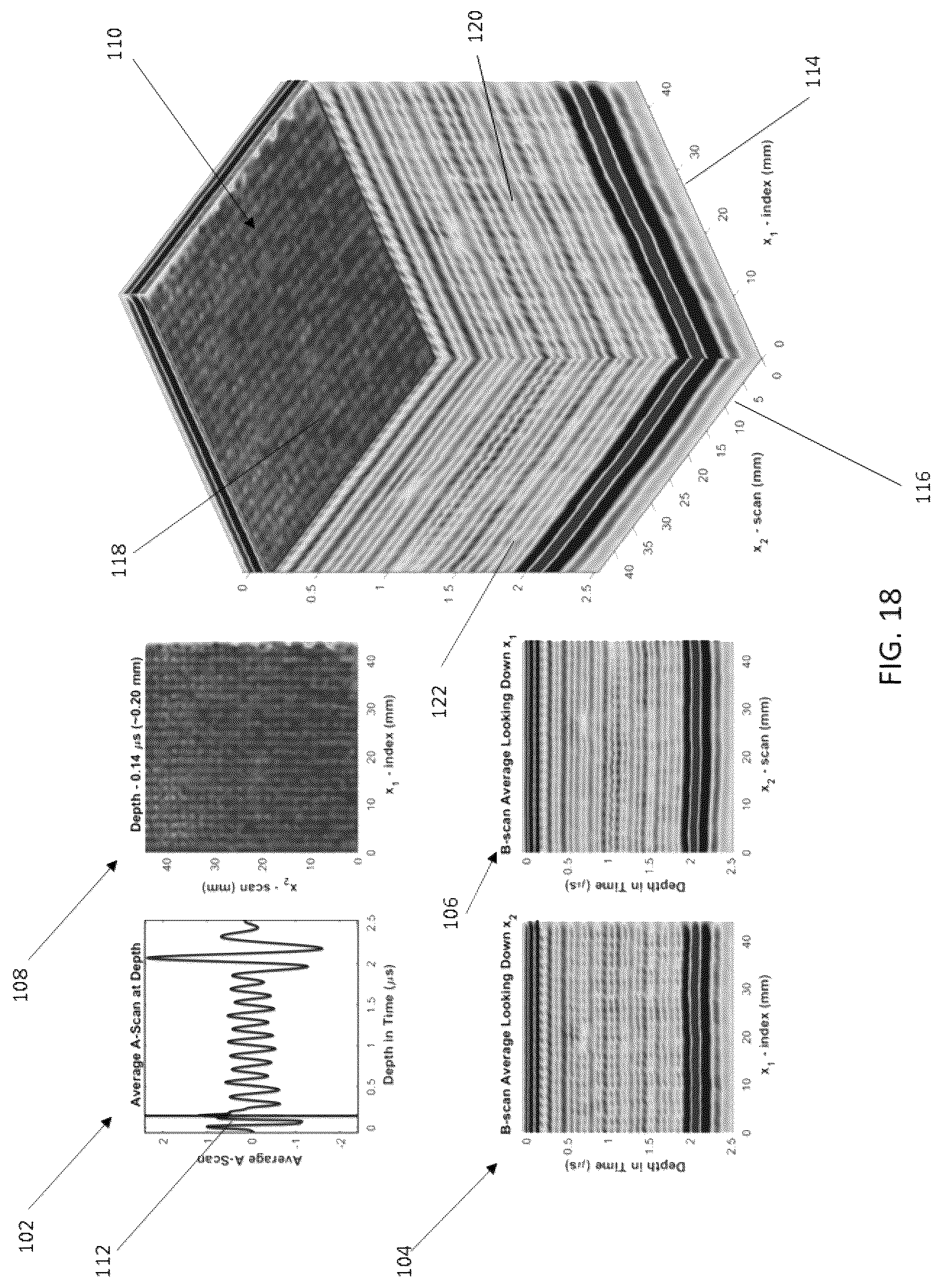 Patent US12618805 Figure 18 – System and method for real-time visualization of foreign objects within a material
