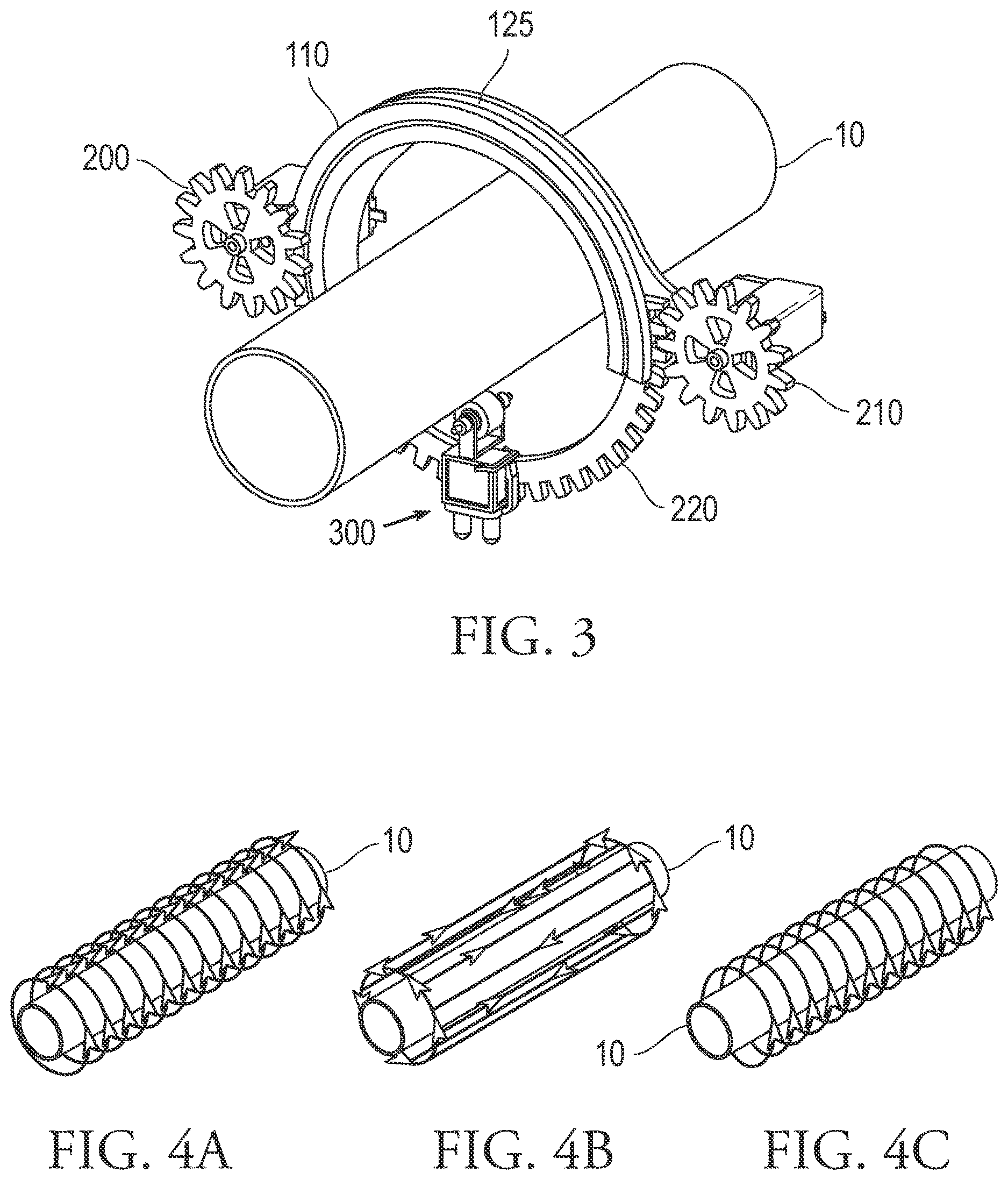 Patent US12618807 Figure 3 – Half ring gear mechanism for ultrasound inspection