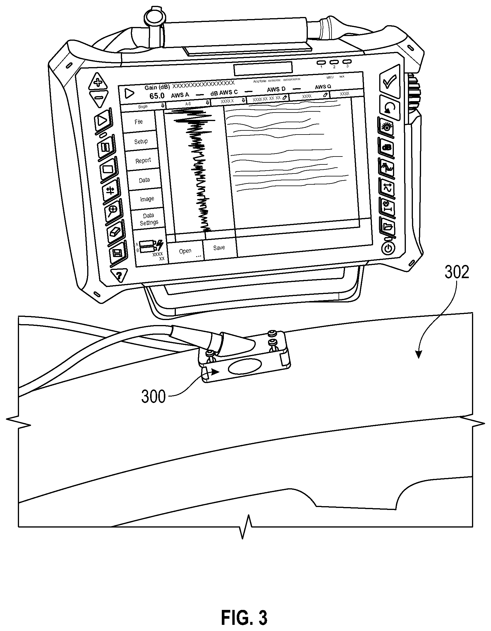 Patent US12618809 Figure 3 – Probe position encoding by ultrasound image correlation